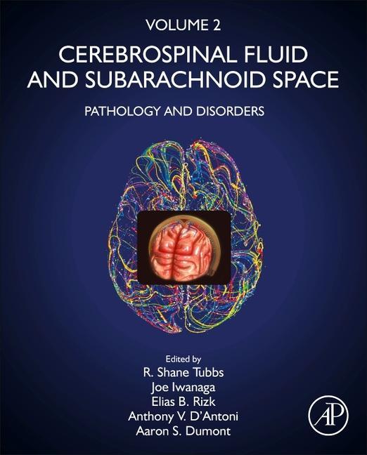 Cerebrospinal Fluid and Subarachnoid Space