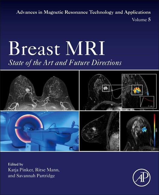 Breast MRI