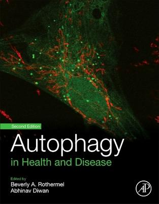 Autophagy in Health and Disease