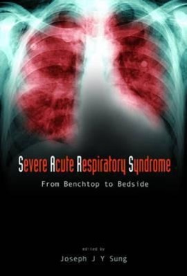 Severe Acute Respiratory Syndrome (Sars): From Benchtop to Bedside