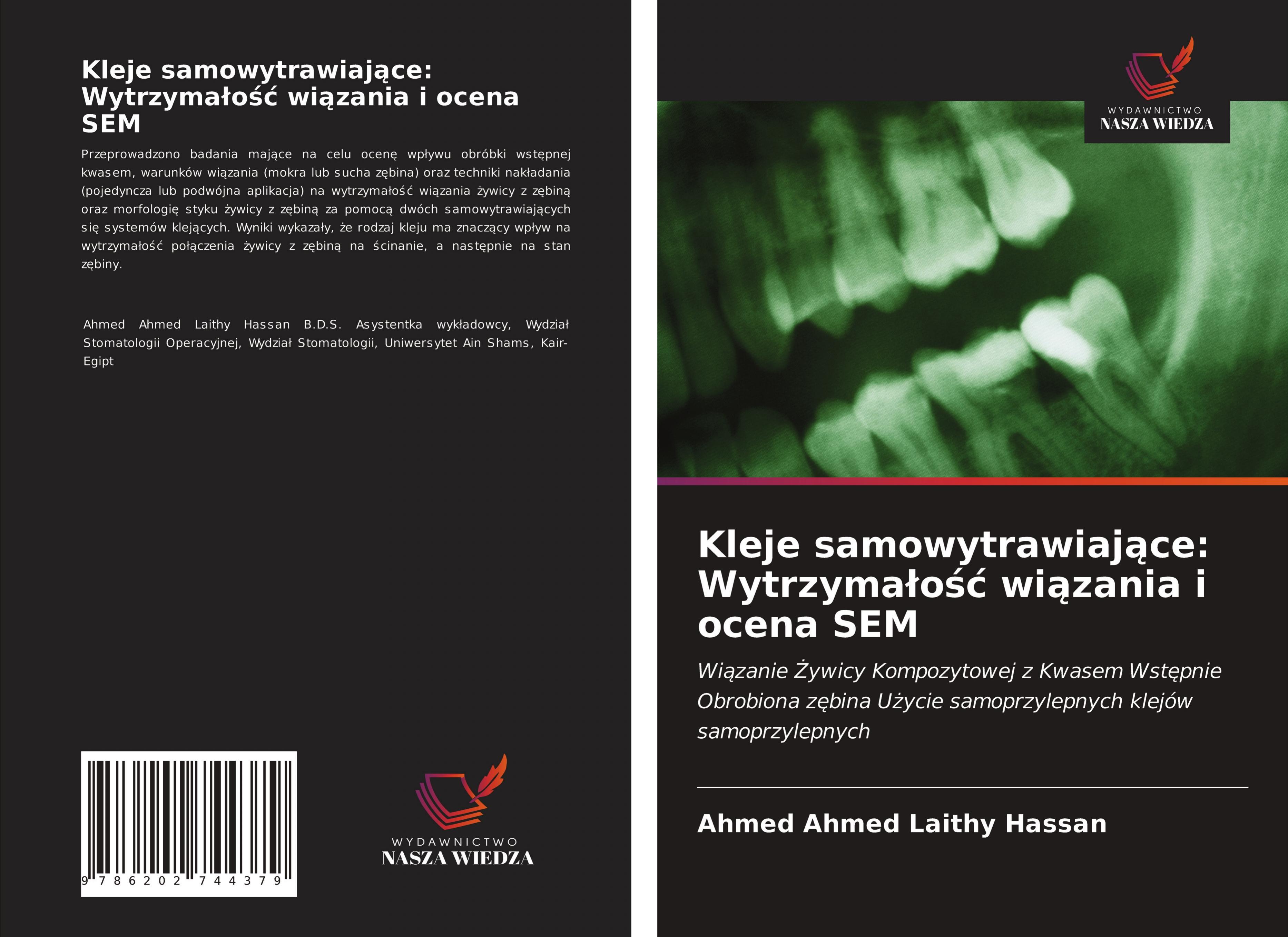 Kleje samowytrawiaj¿ce: Wytrzyma¿o¿¿ wi¿zania i ocena SEM