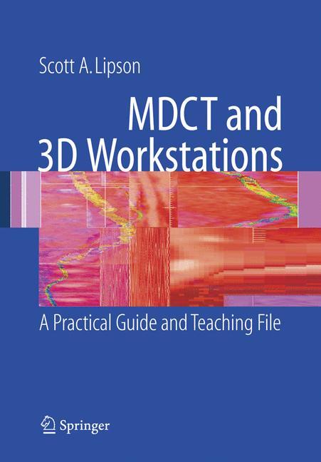 MDCT and 3D Workstations