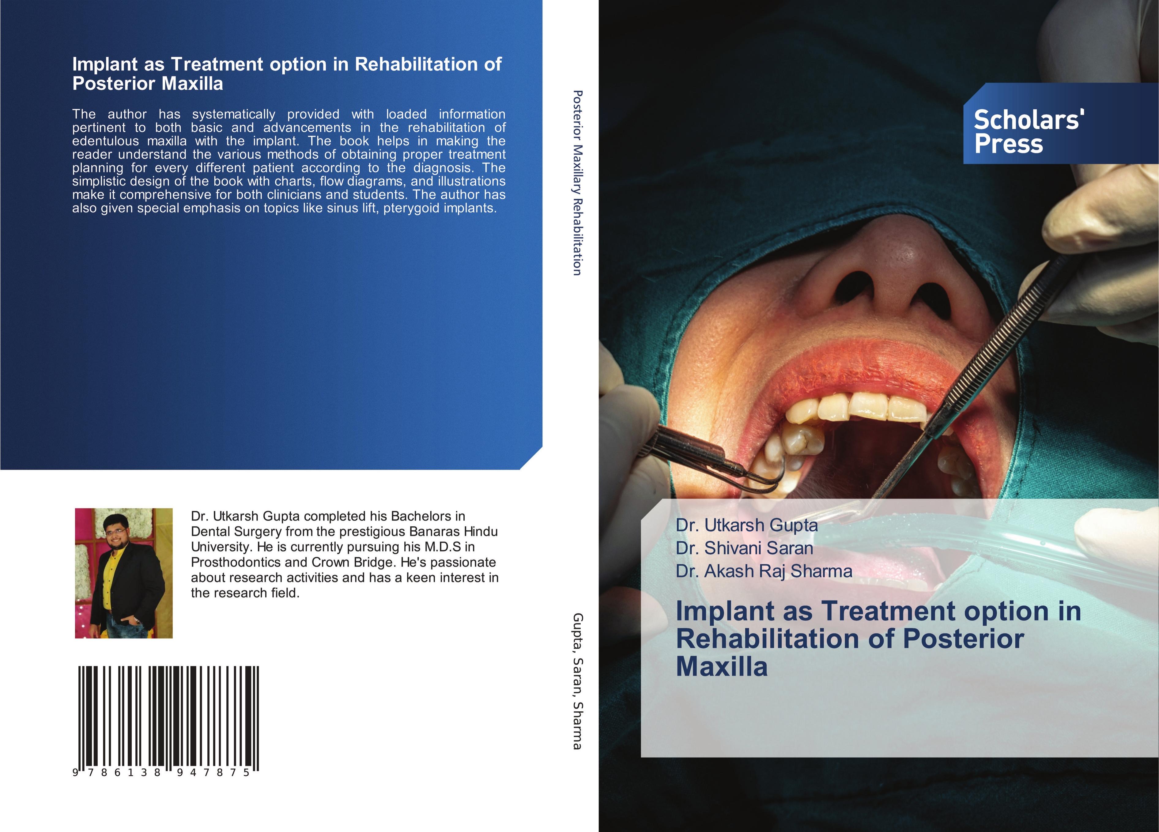 Implant as Treatment option in Rehabilitation of Posterior Maxilla