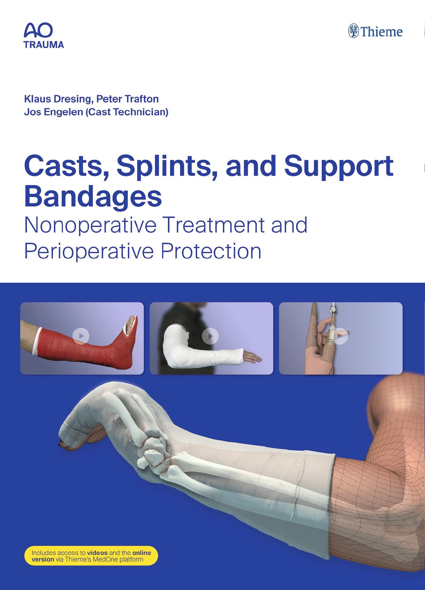 Casts, Splints, and Support Bandages