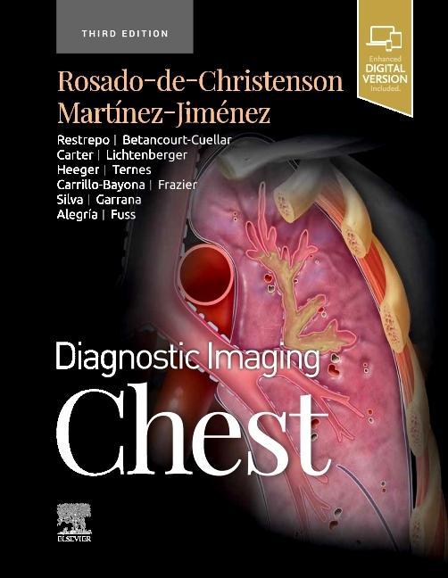 Diagnostic Imaging: Chest