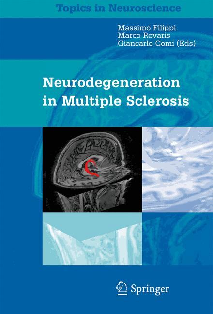 Neurodegeneration in Multiple Sclerosis