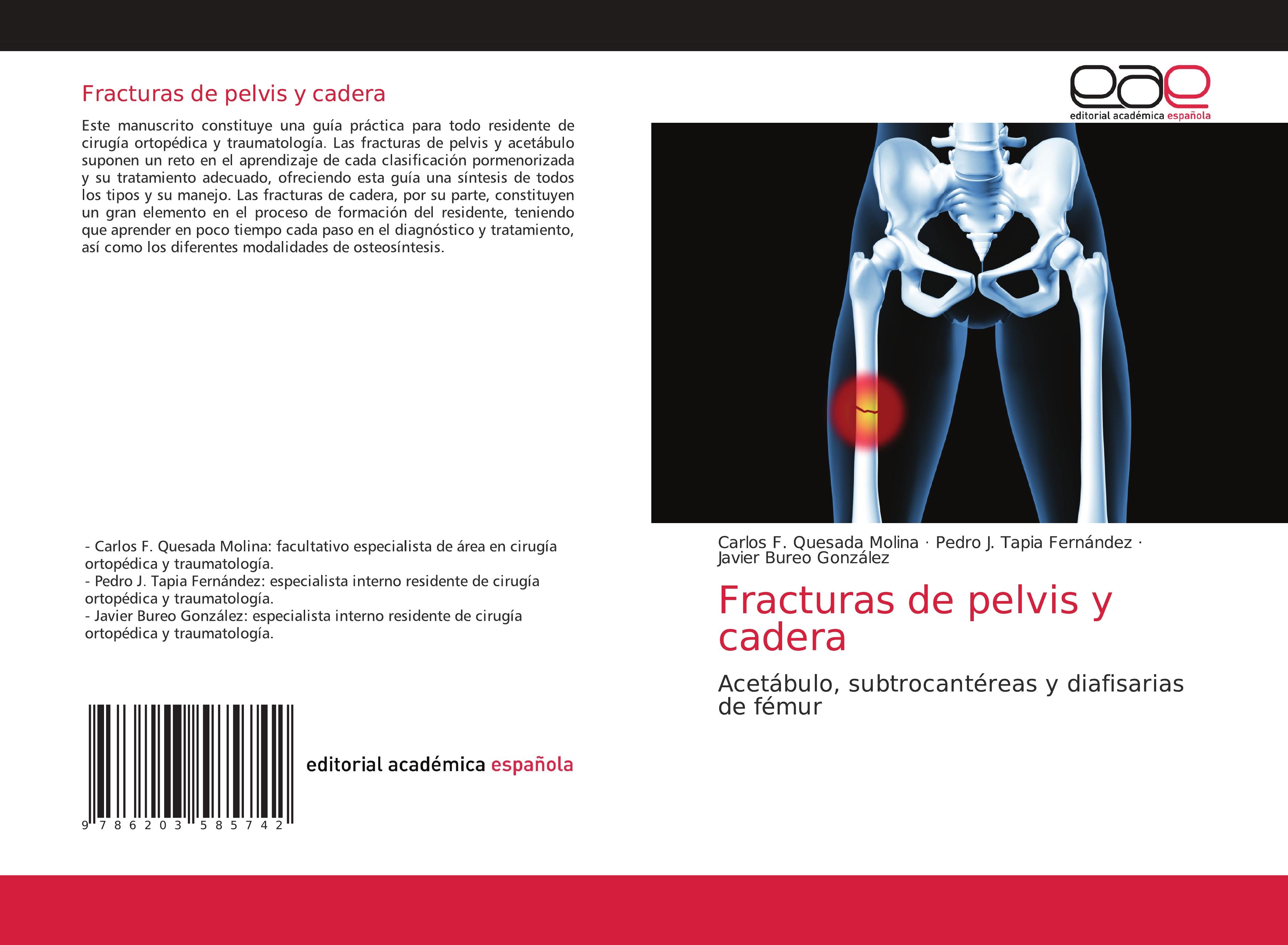 Fracturas de pelvis y cadera