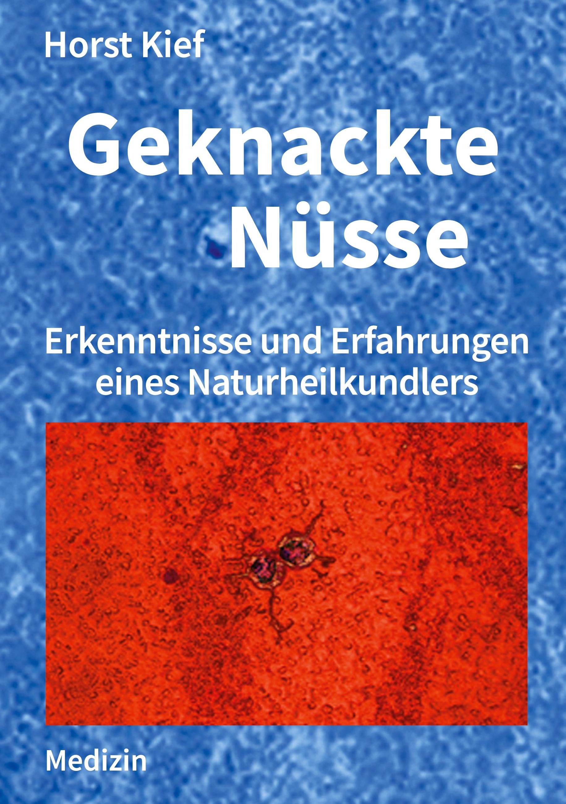 Geknackte Nüsse