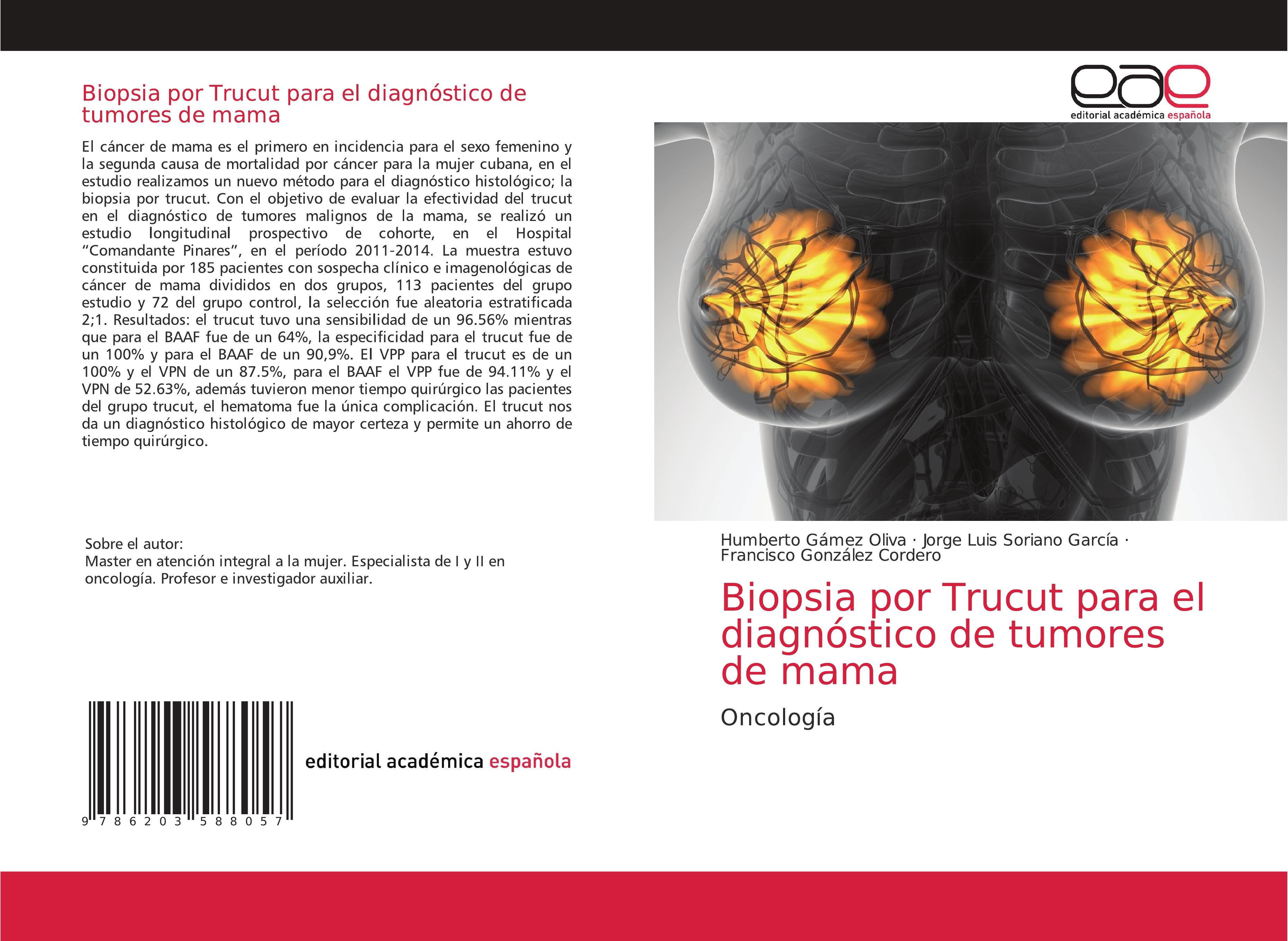 Biopsia por Trucut para el diagnóstico de tumores de mama