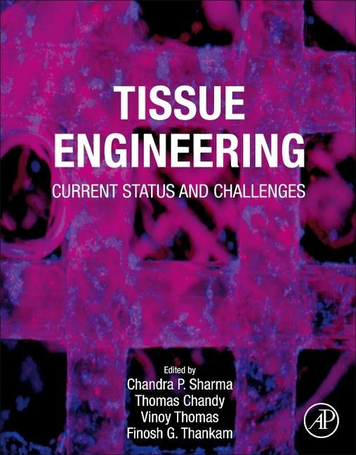 Tissue Engineering: Current Status and Challenges