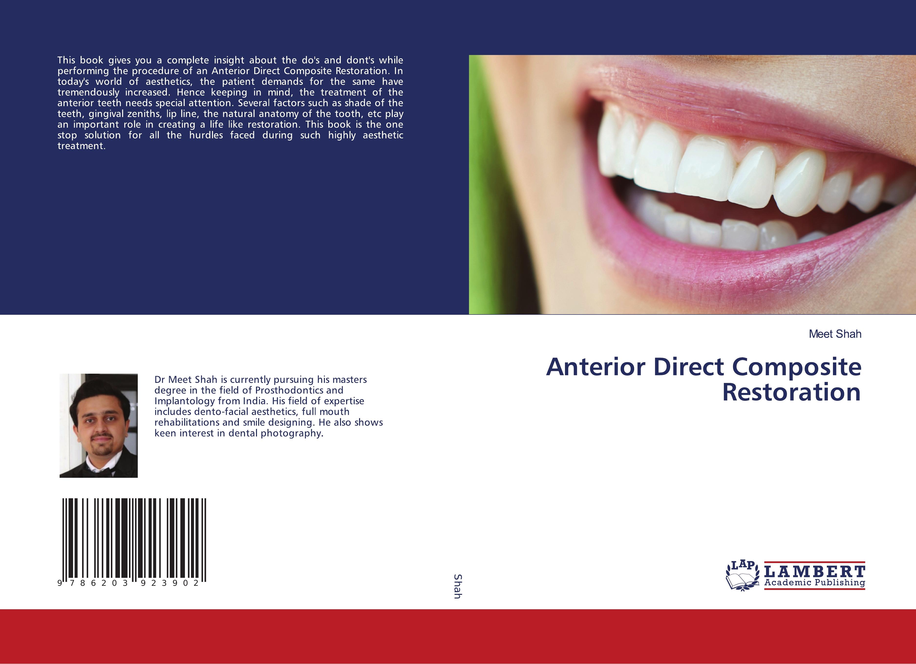 Anterior Direct Composite Restoration