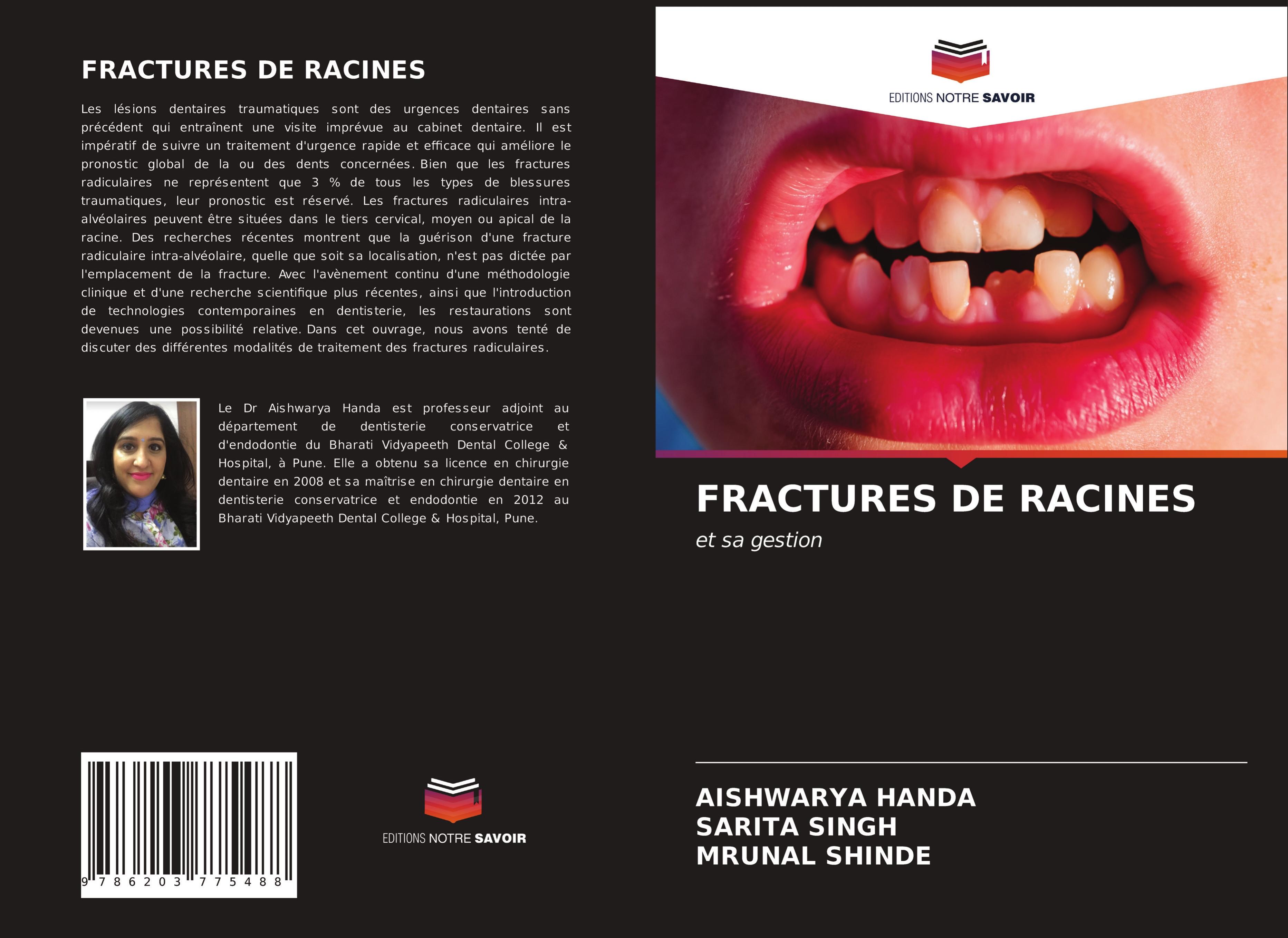 FRACTURES DE RACINES