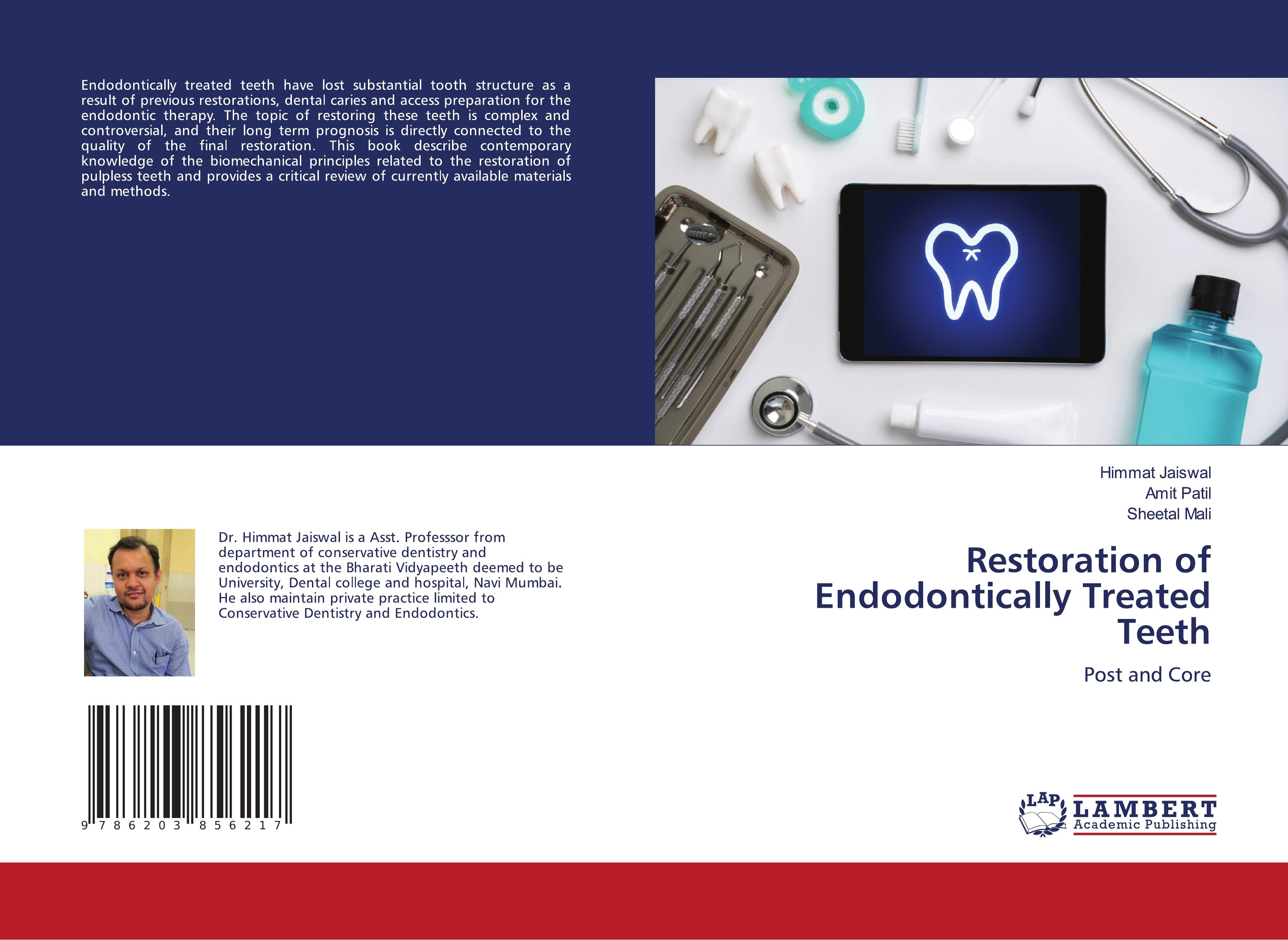 Restoration of Endodontically Treated Teeth