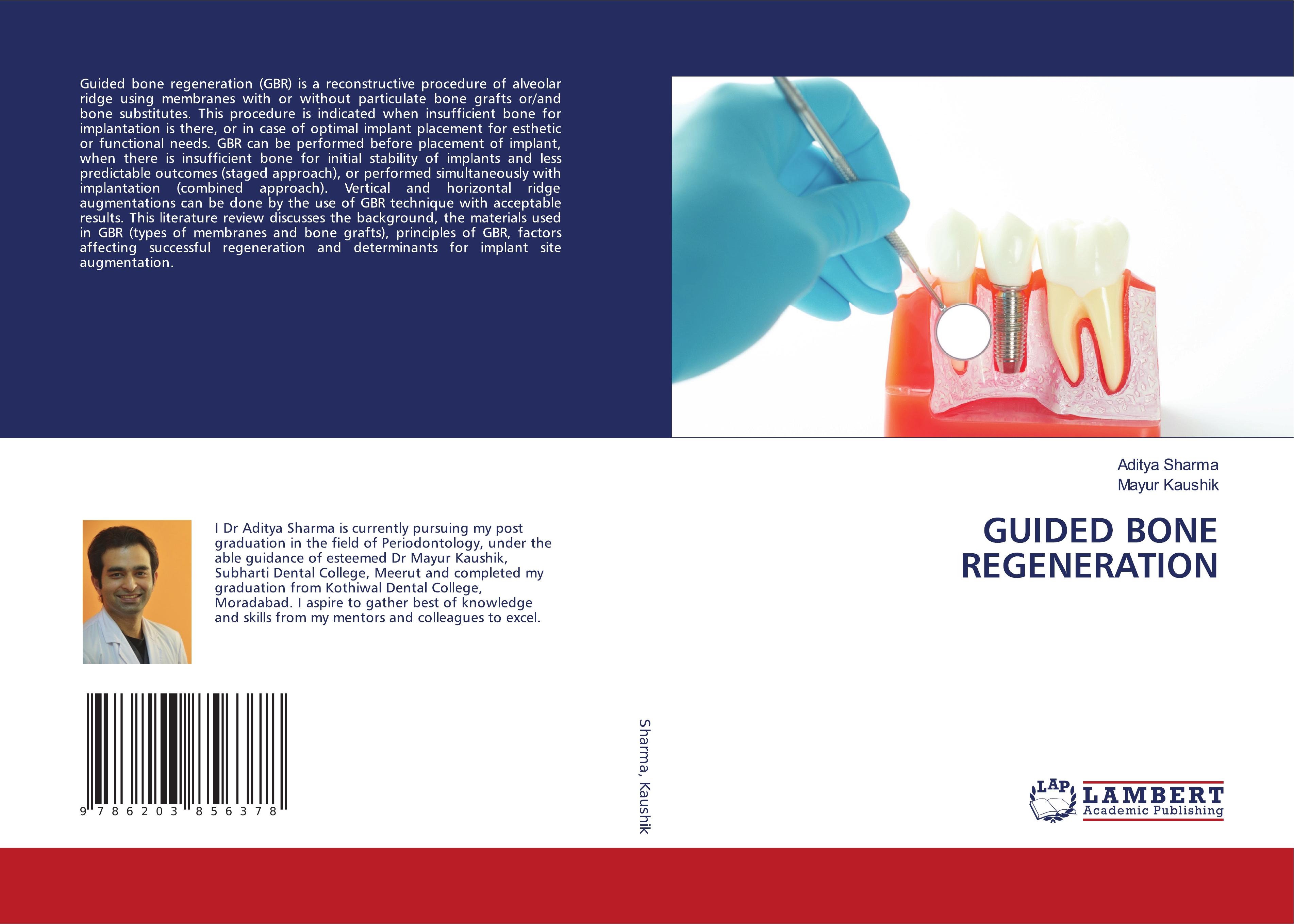 GUIDED BONE REGENERATION