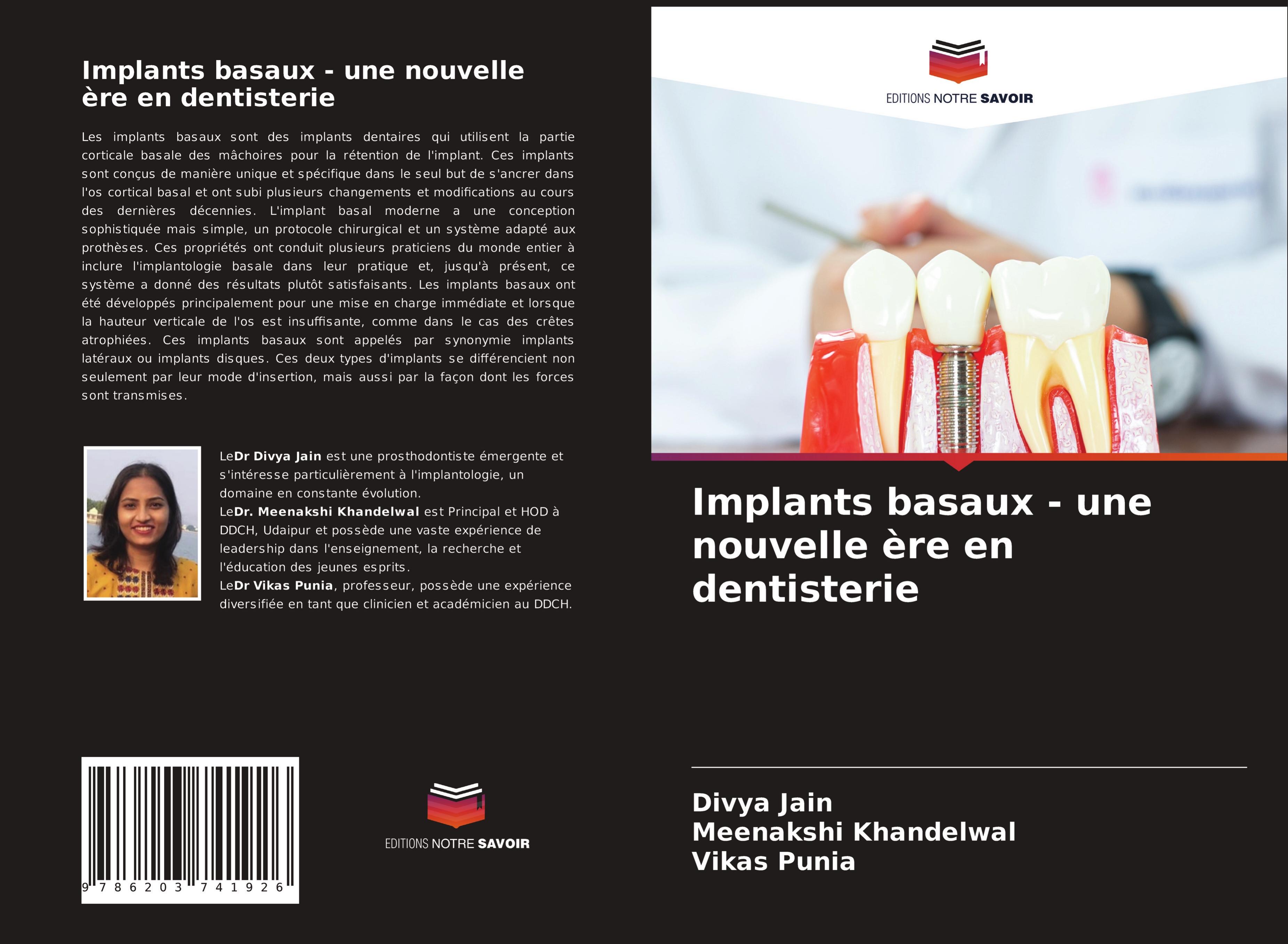 Implants basaux - une nouvelle ère en dentisterie