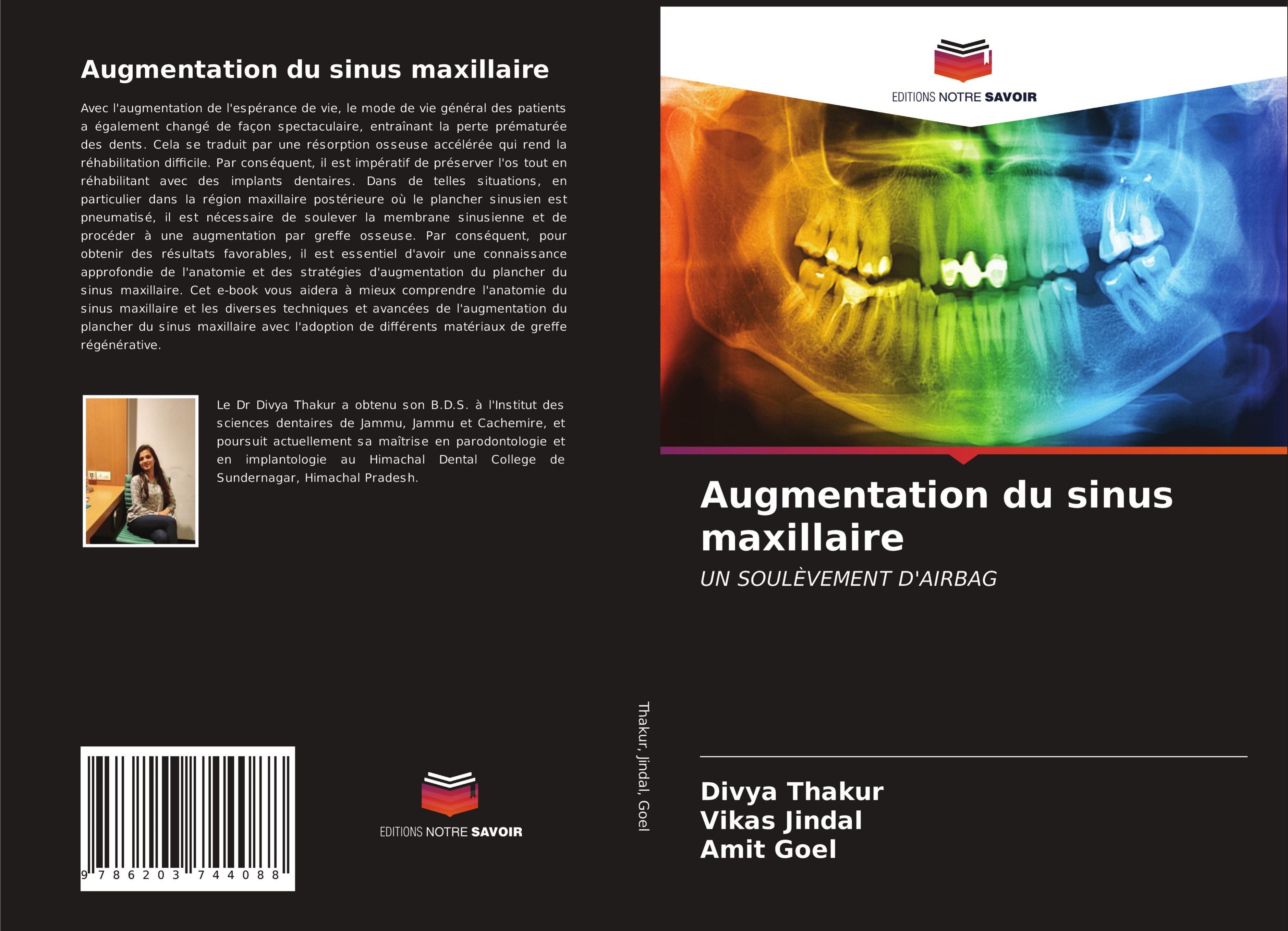 Augmentation du sinus maxillaire