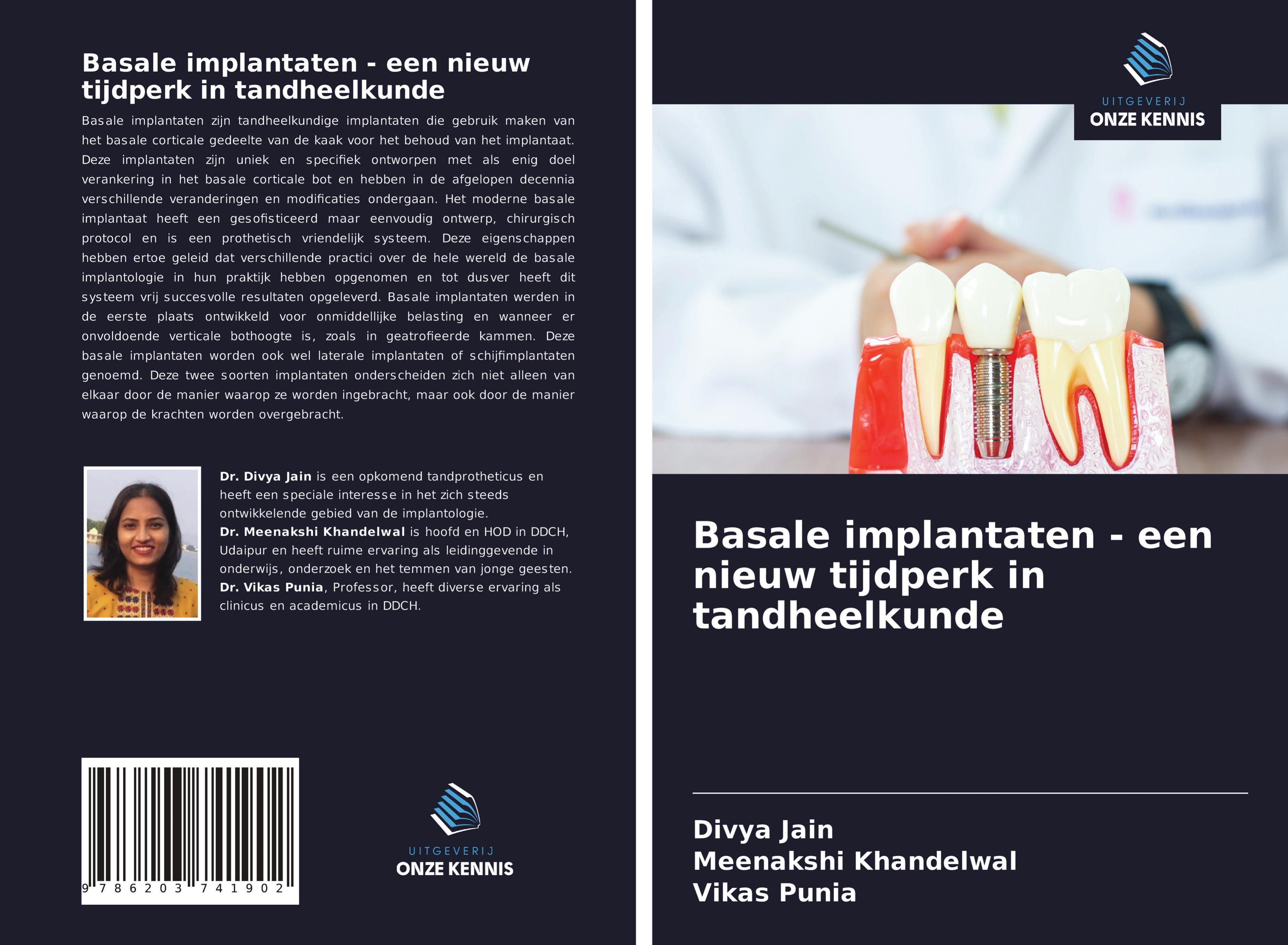 Basale implantaten - een nieuw tijdperk in tandheelkunde