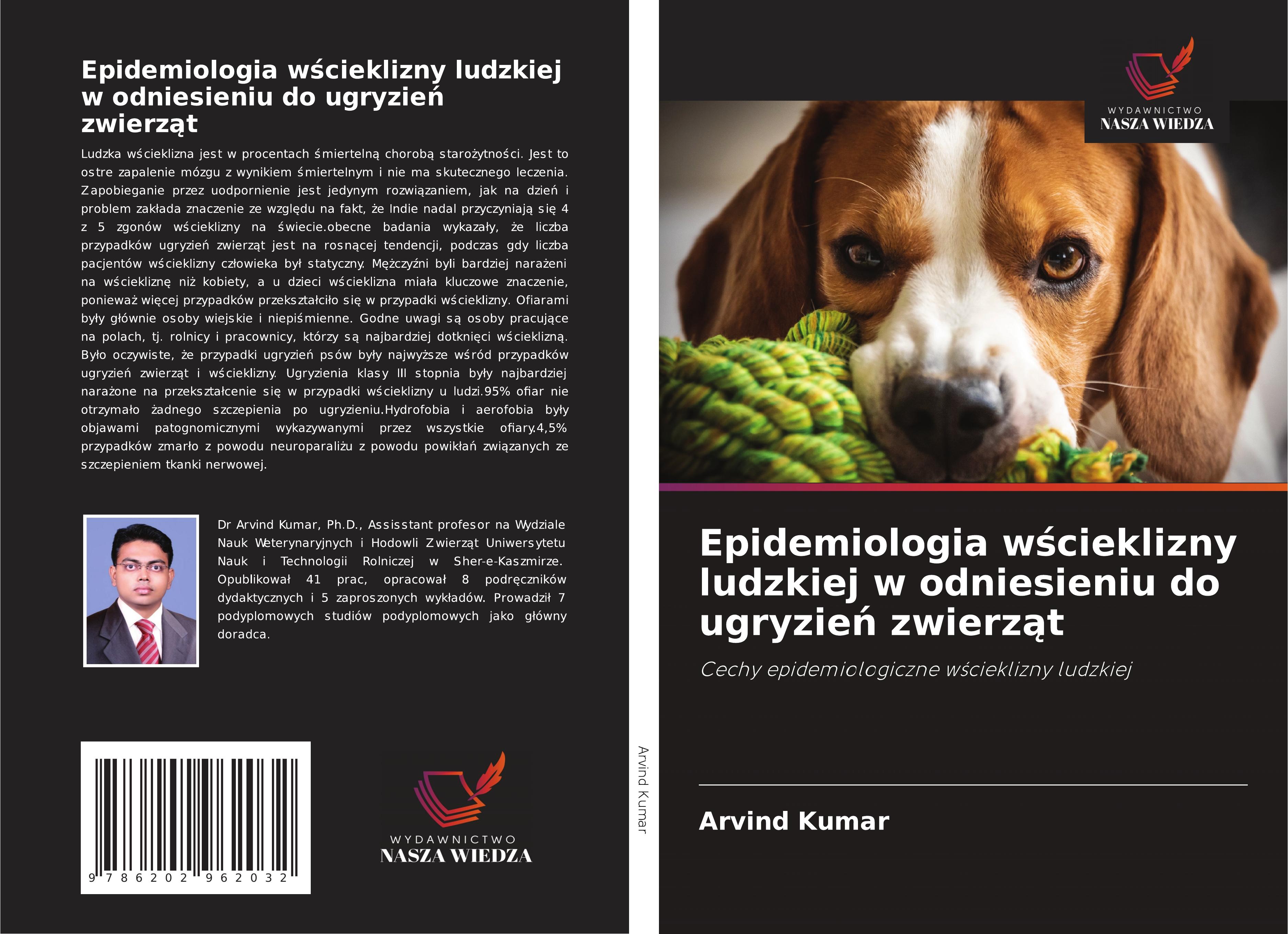 Epidemiologia w¿cieklizny ludzkiej w odniesieniu do ugryzie¿ zwierz¿t