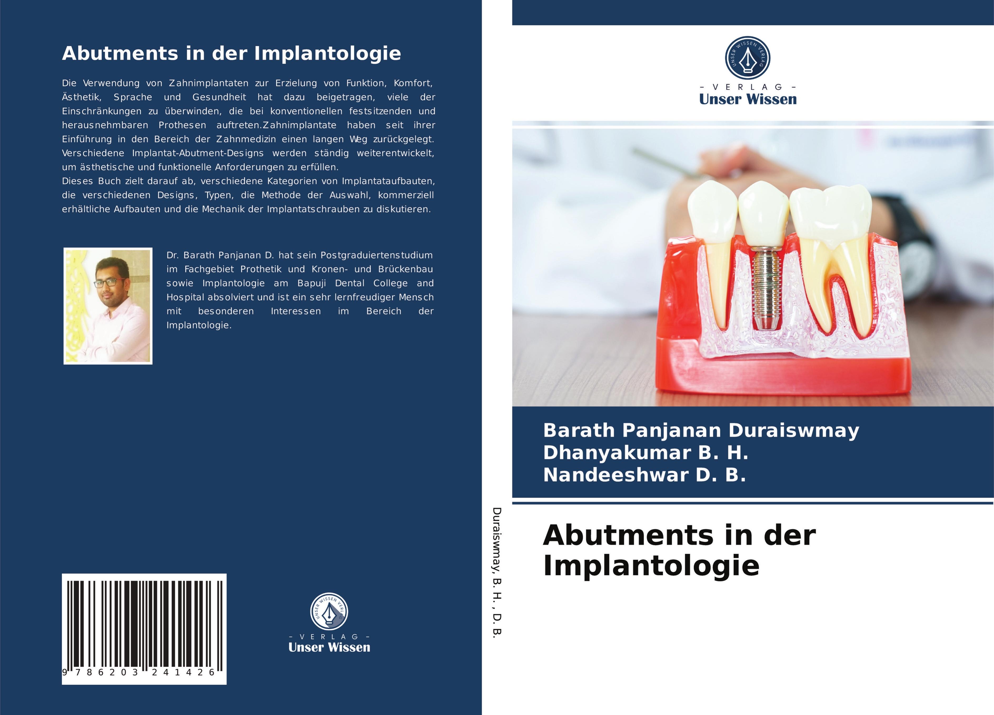 Abutments in der Implantologie