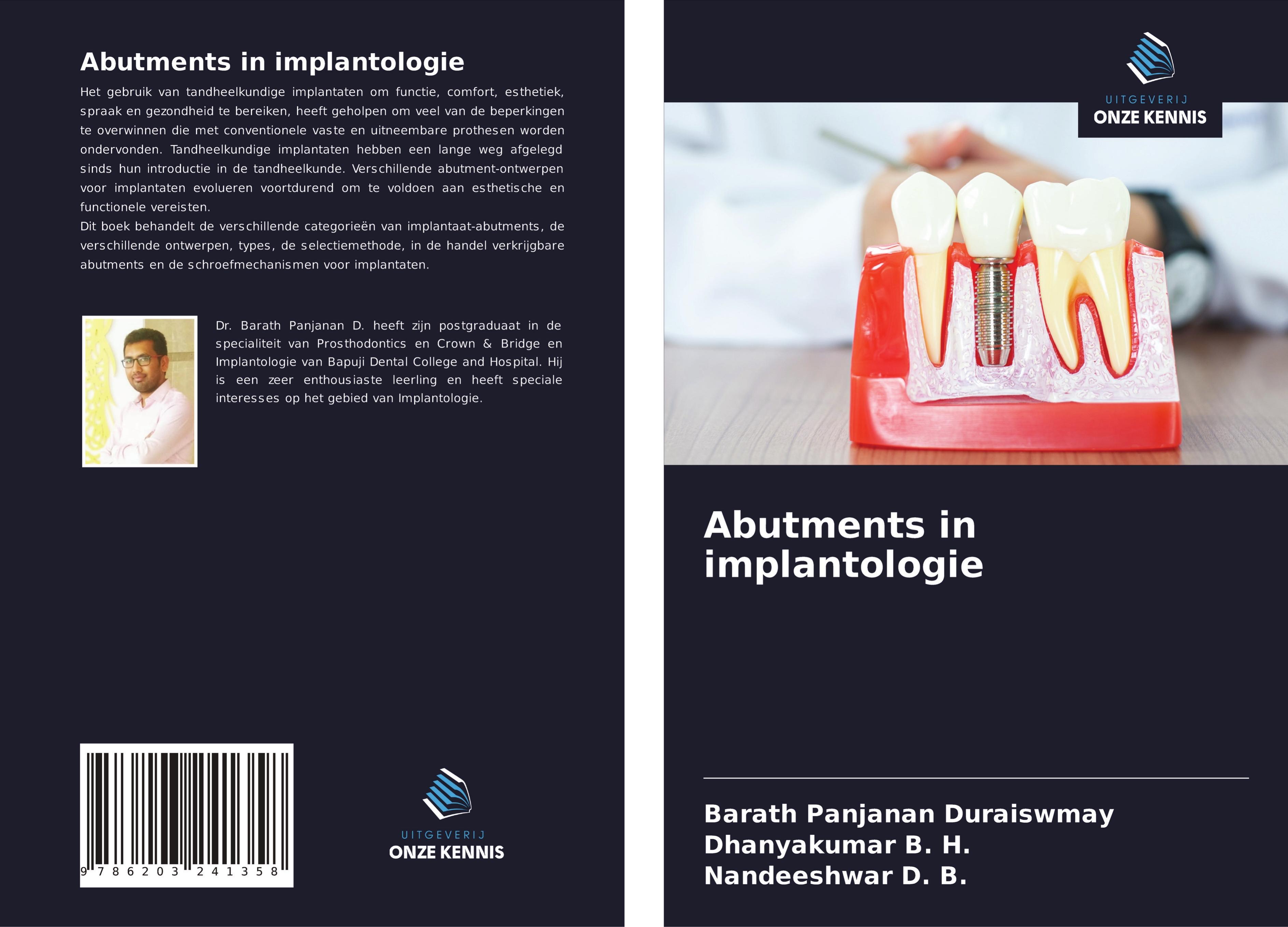 Abutments in implantologie