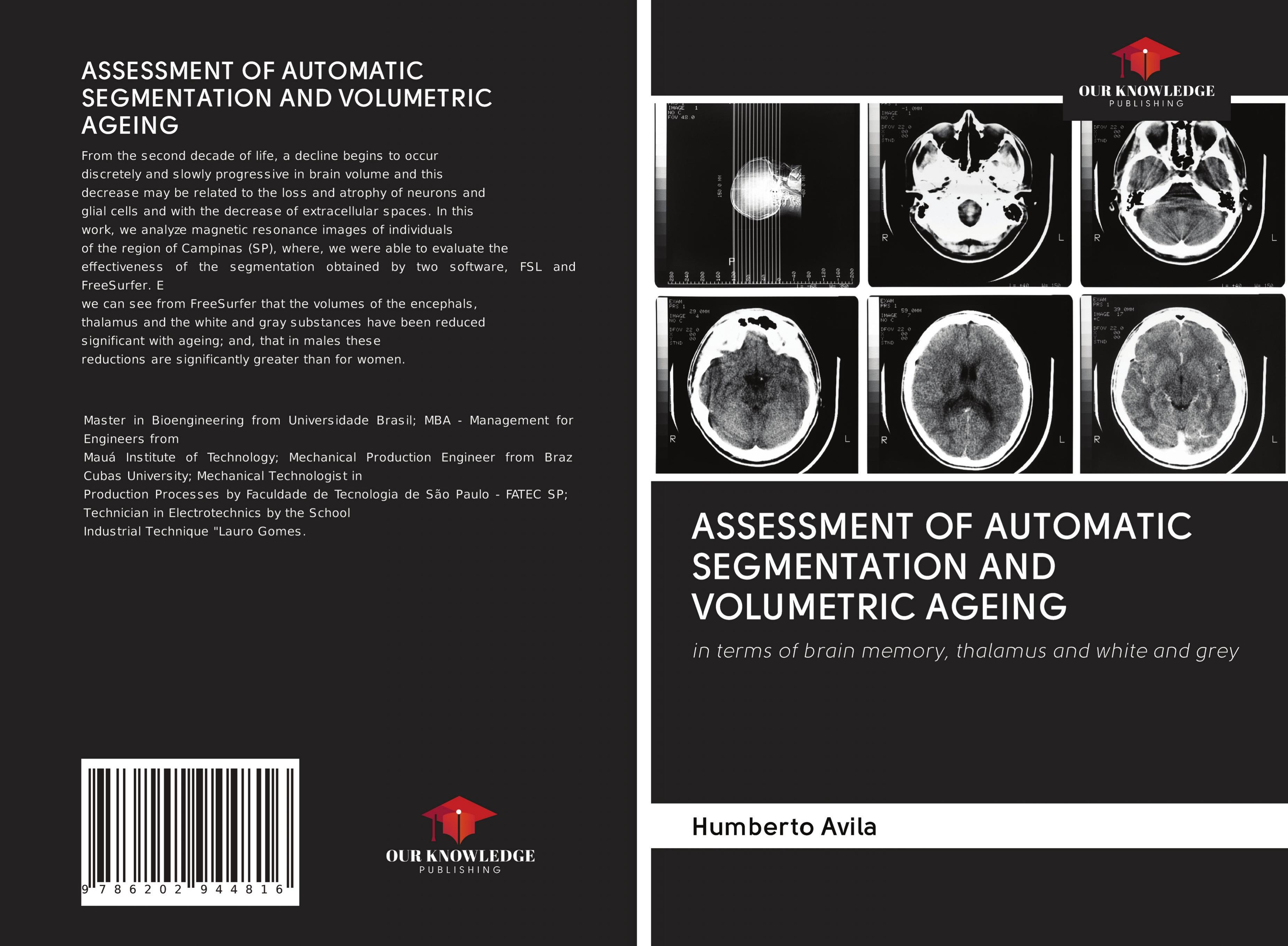 ASSESSMENT OF AUTOMATIC SEGMENTATION AND VOLUMETRIC AGEING