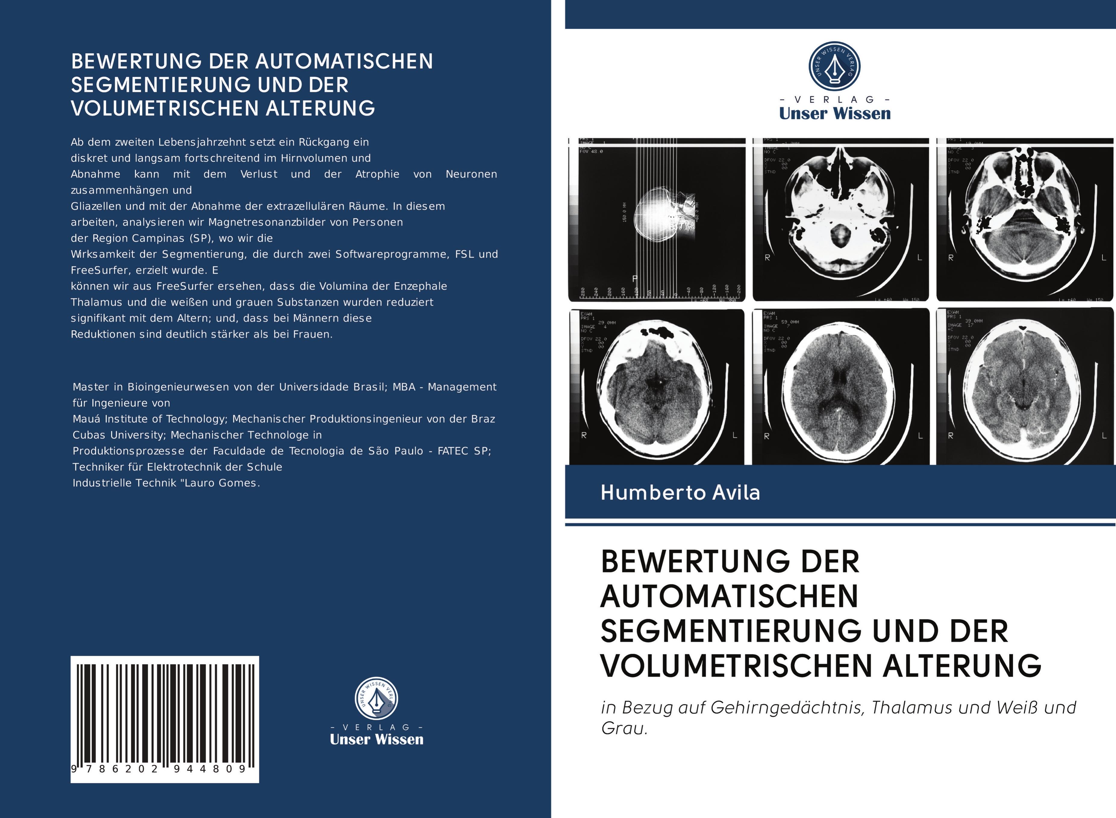 BEWERTUNG DER AUTOMATISCHEN SEGMENTIERUNG UND DER VOLUMETRISCHEN ALTERUNG