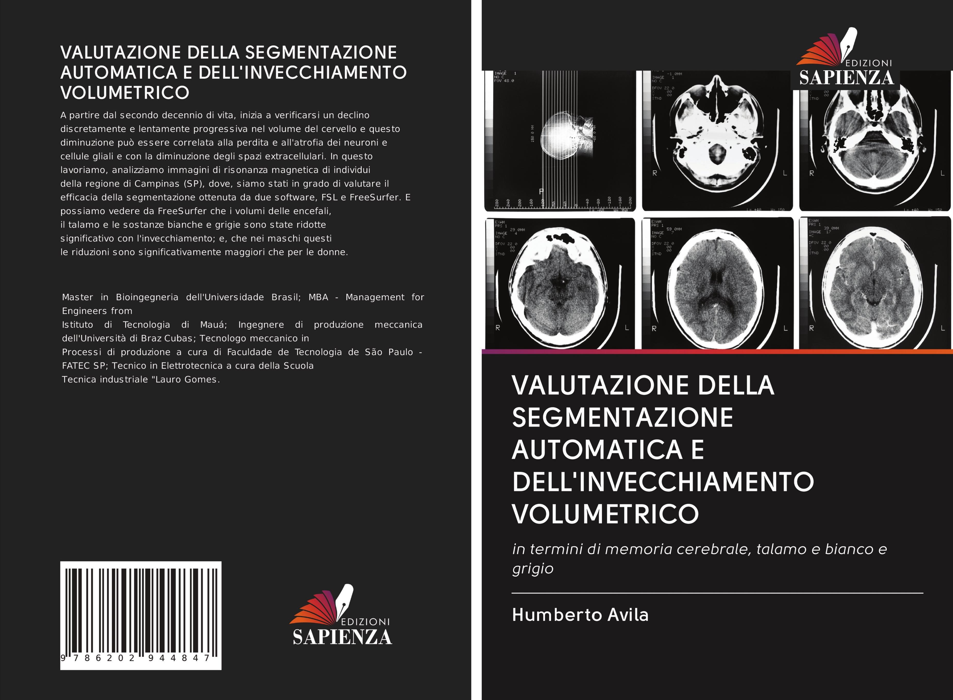 VALUTAZIONE DELLA SEGMENTAZIONE AUTOMATICA E DELL'INVECCHIAMENTO VOLUMETRICO