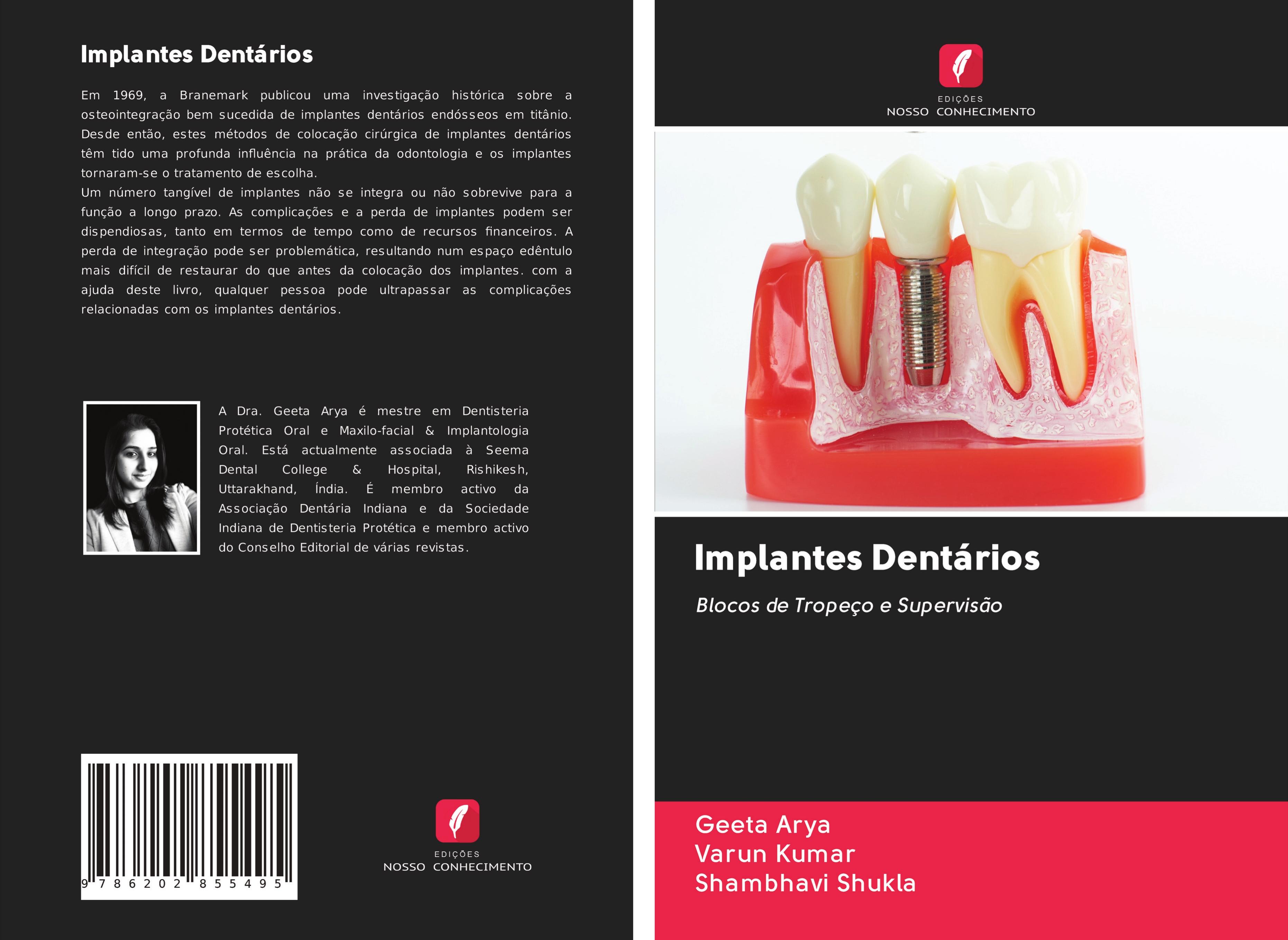 Implantes Dentários