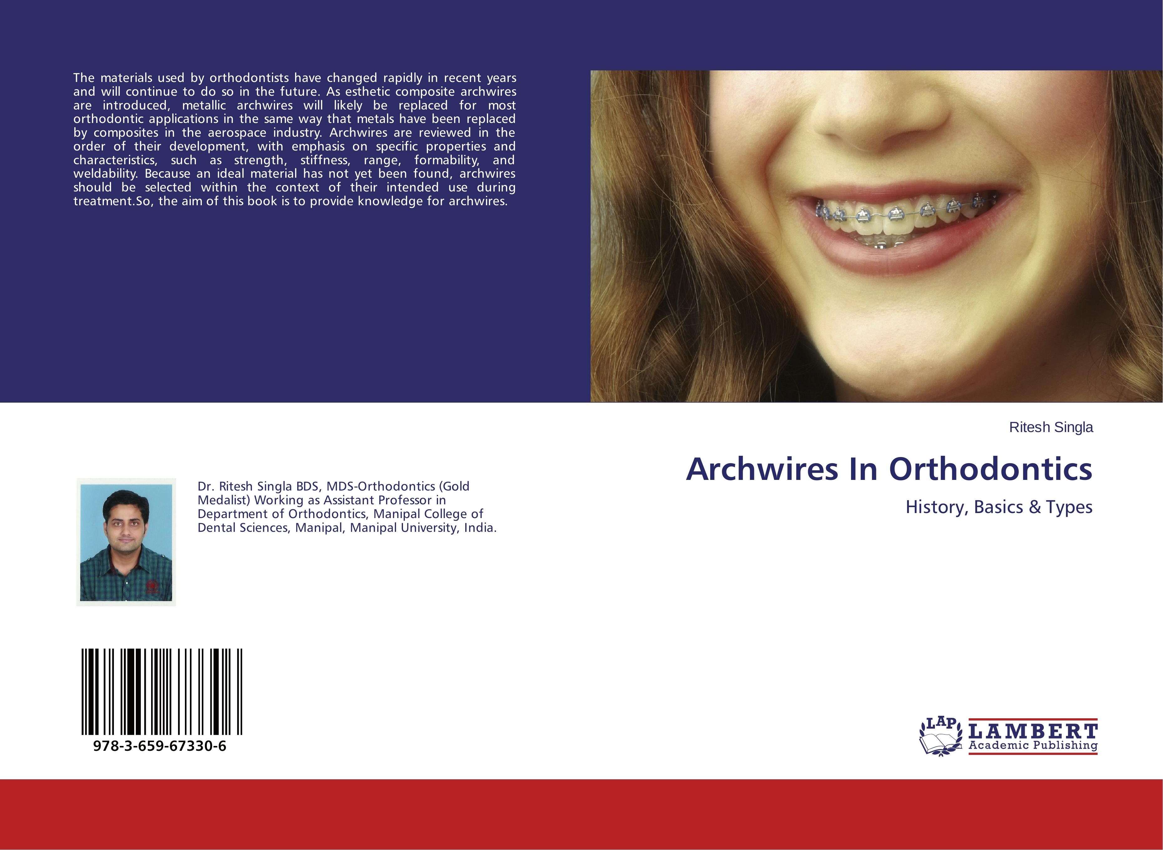 Archwires In Orthodontics