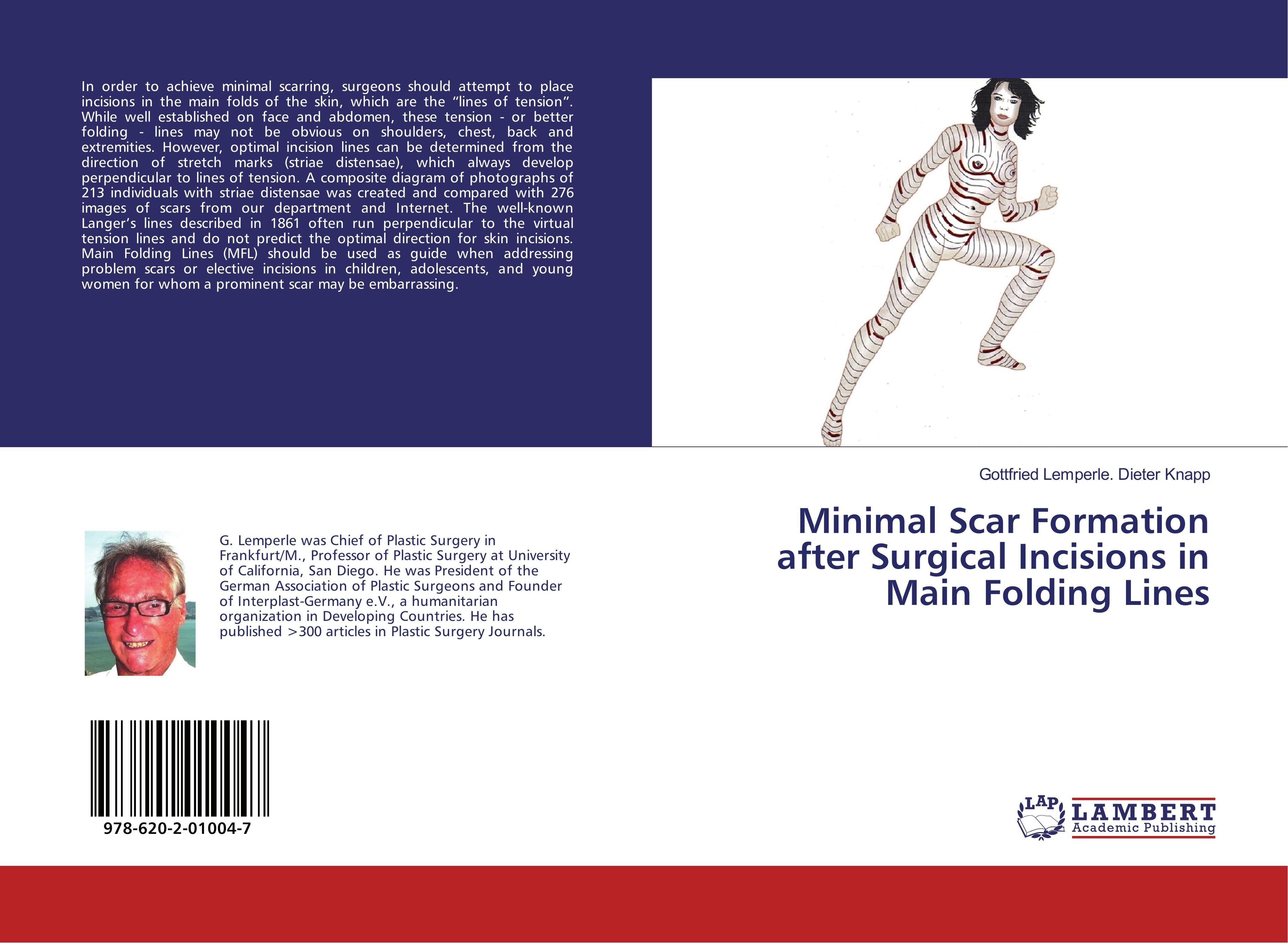 Minimal Scar Formation after Surgical Incisions in Main Folding Lines