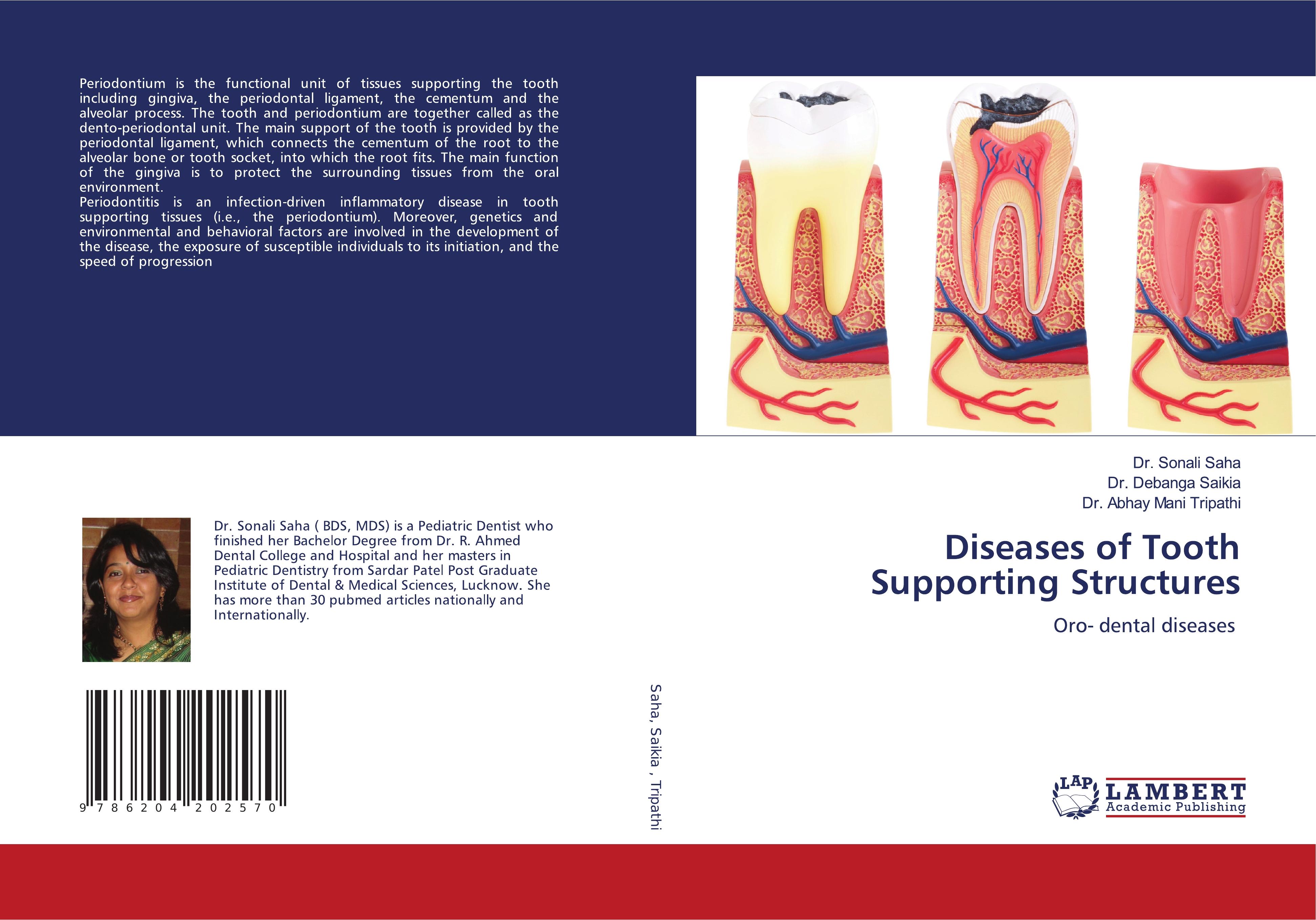 Diseases of Tooth Supporting Structures