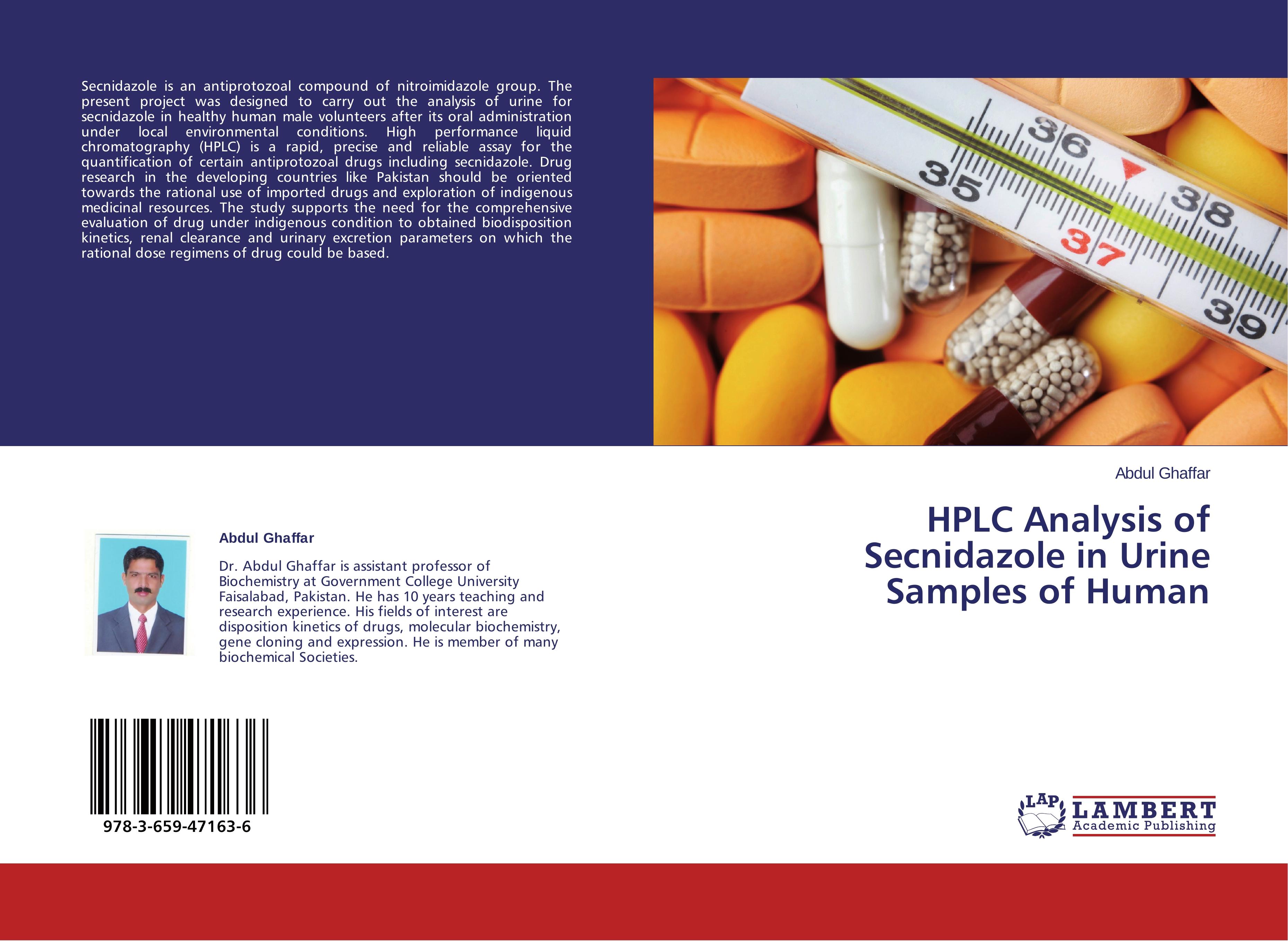 HPLC Analysis of Secnidazole in Urine Samples of Human