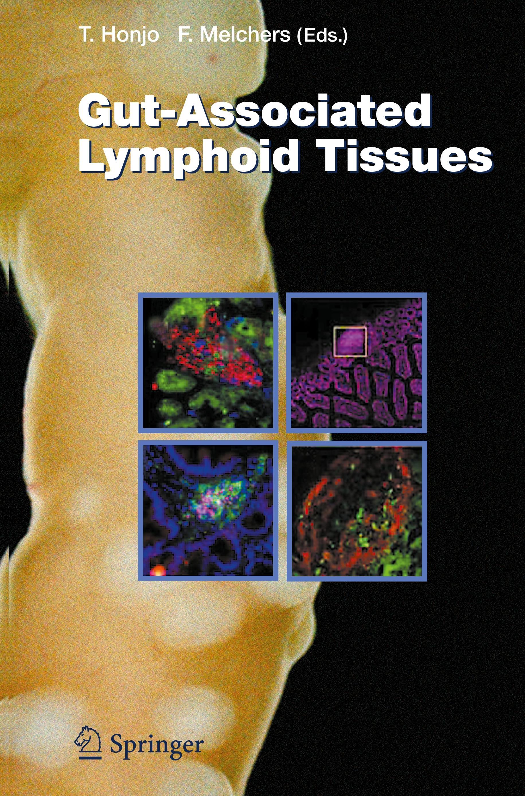 Gut-Associated Lymphoid Tissues