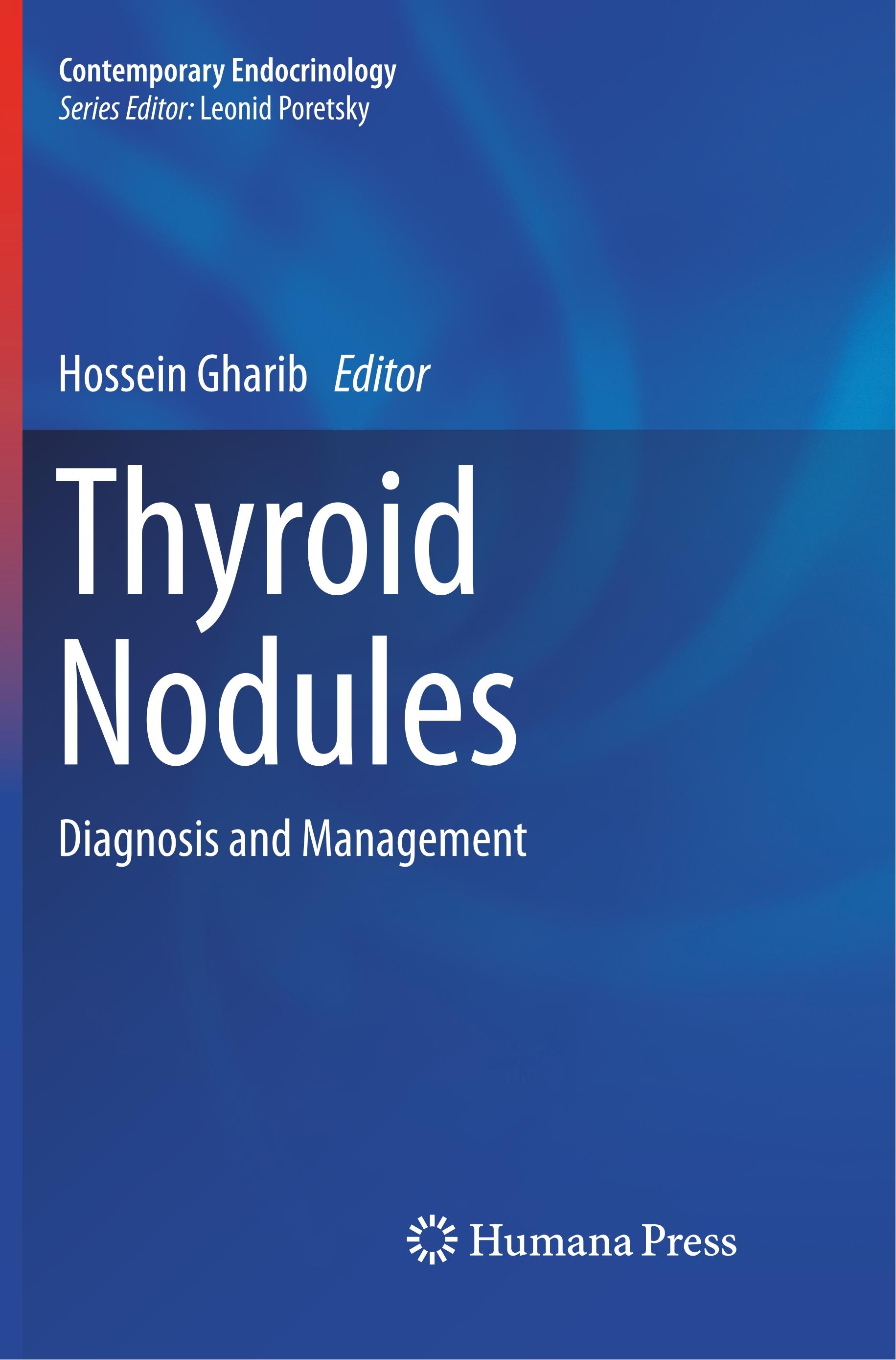 Thyroid Nodules