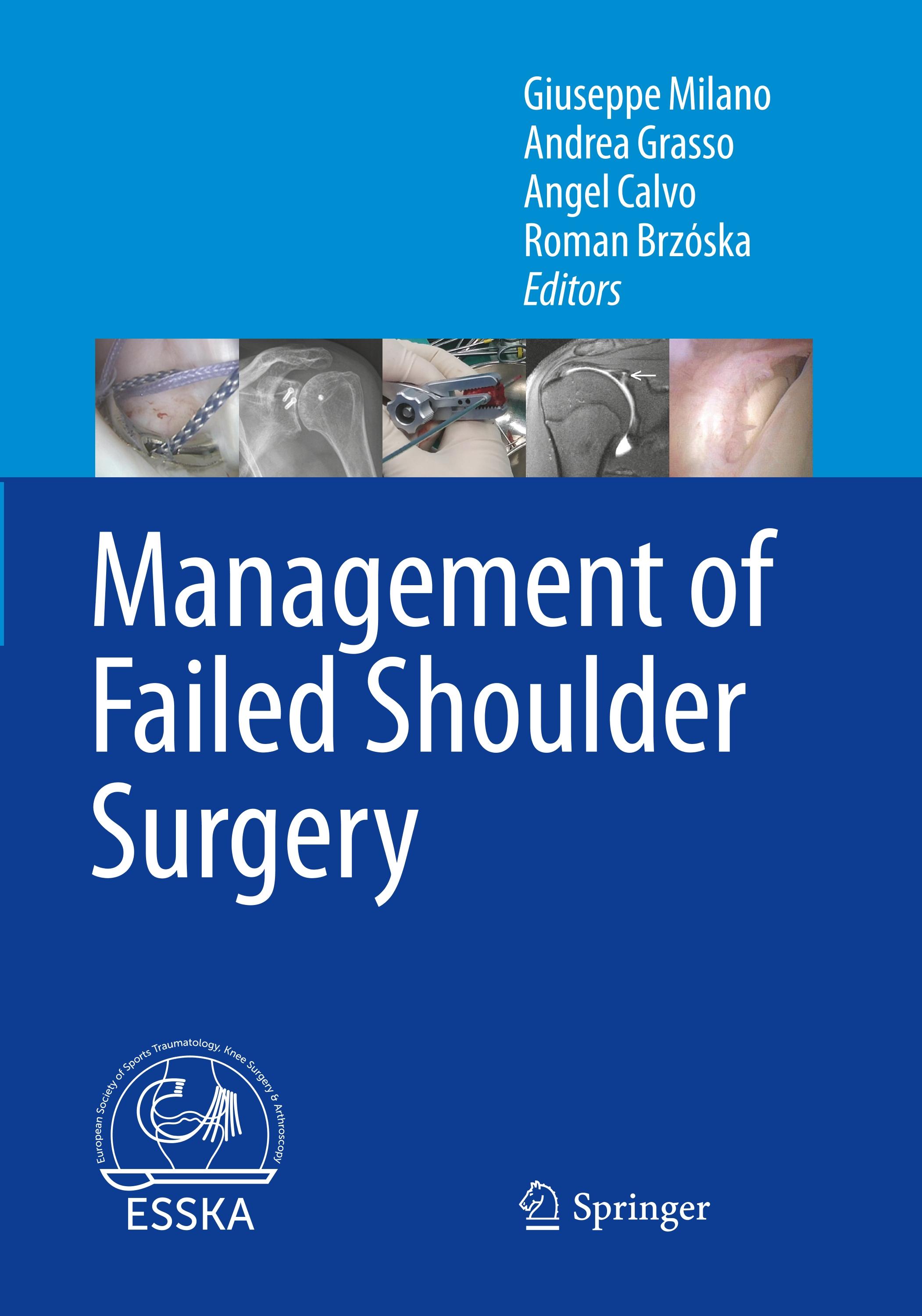 Management of Failed Shoulder Surgery