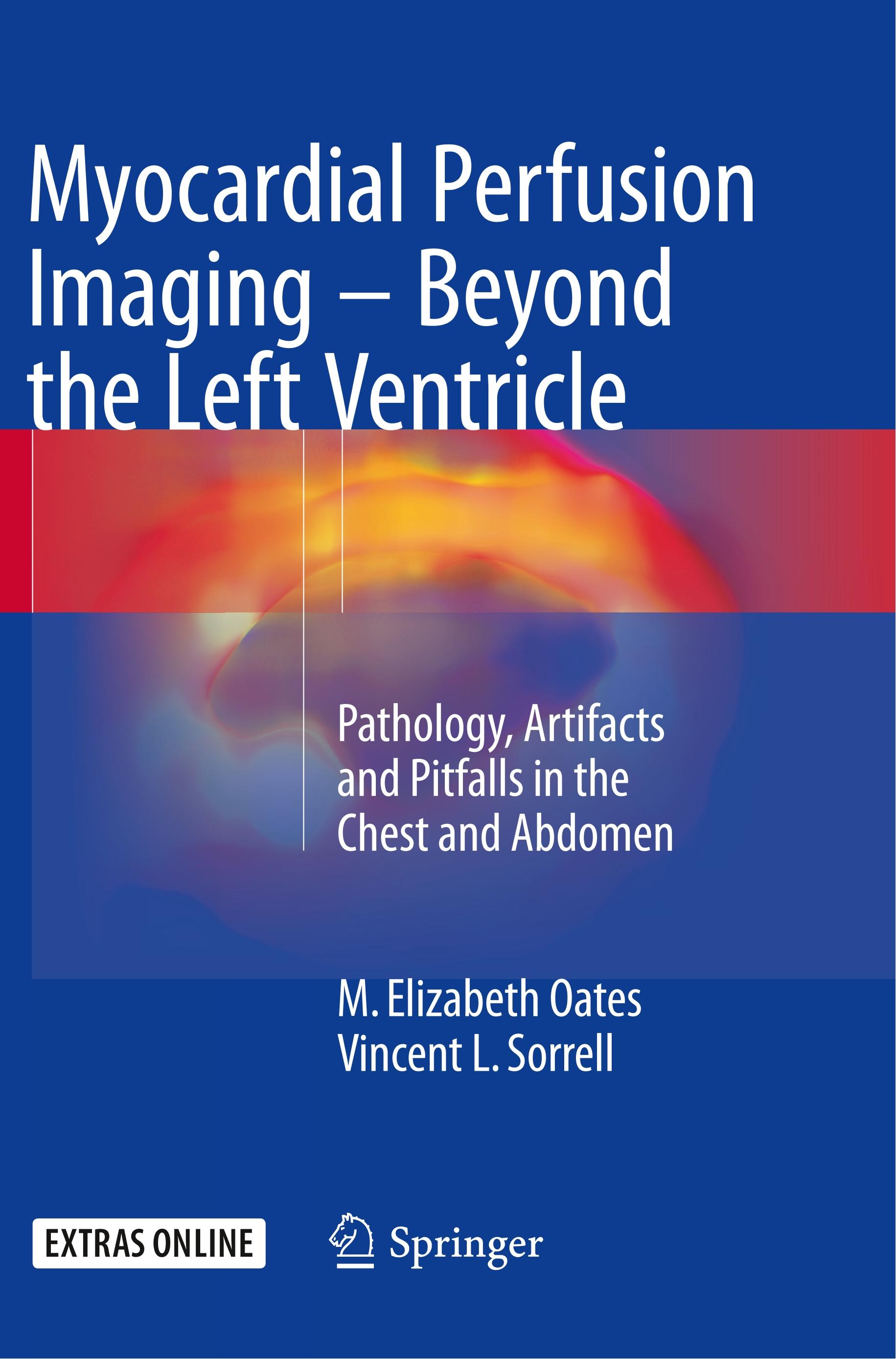 Myocardial Perfusion Imaging - Beyond the Left Ventricle