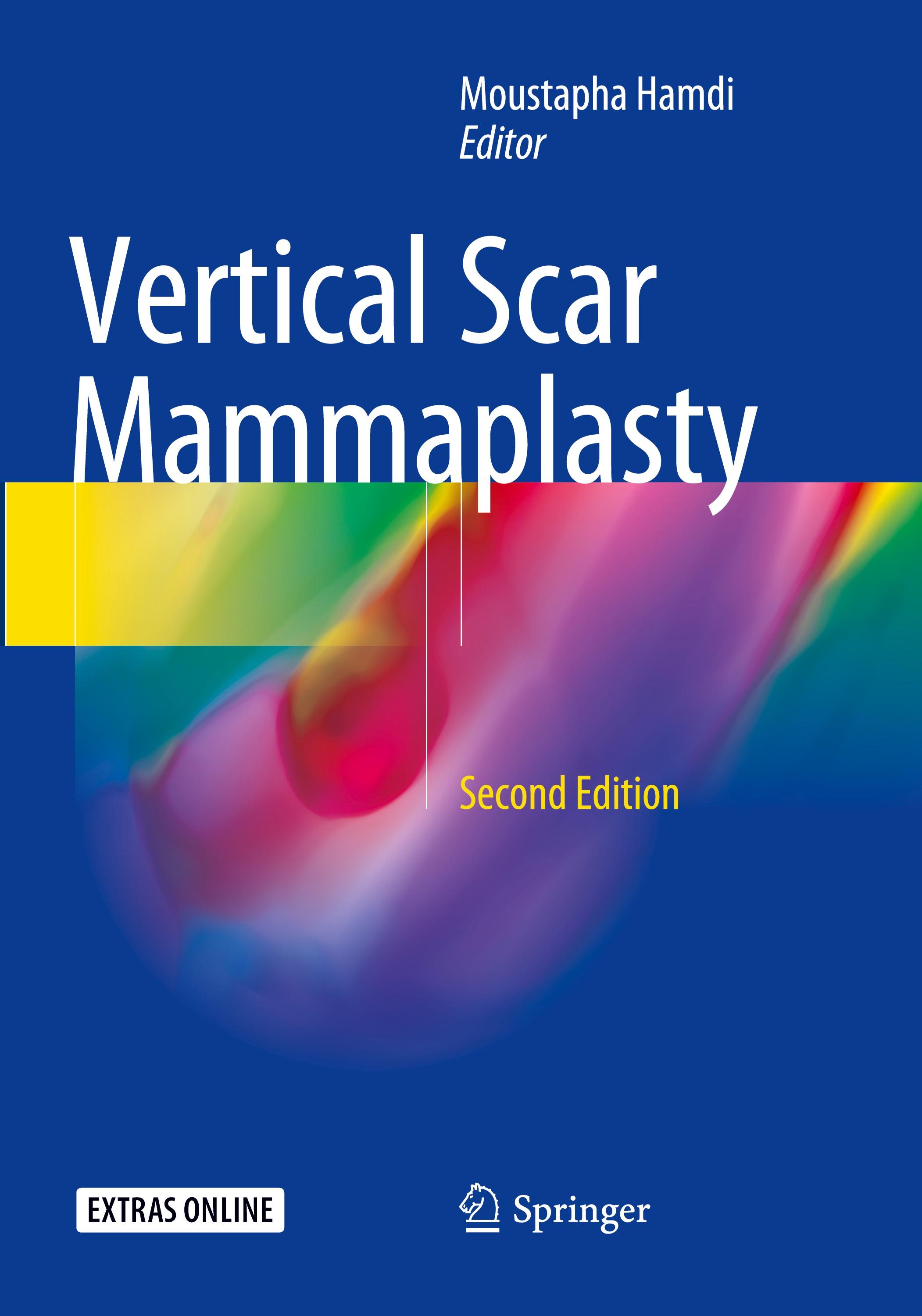 Vertical Scar Mammaplasty