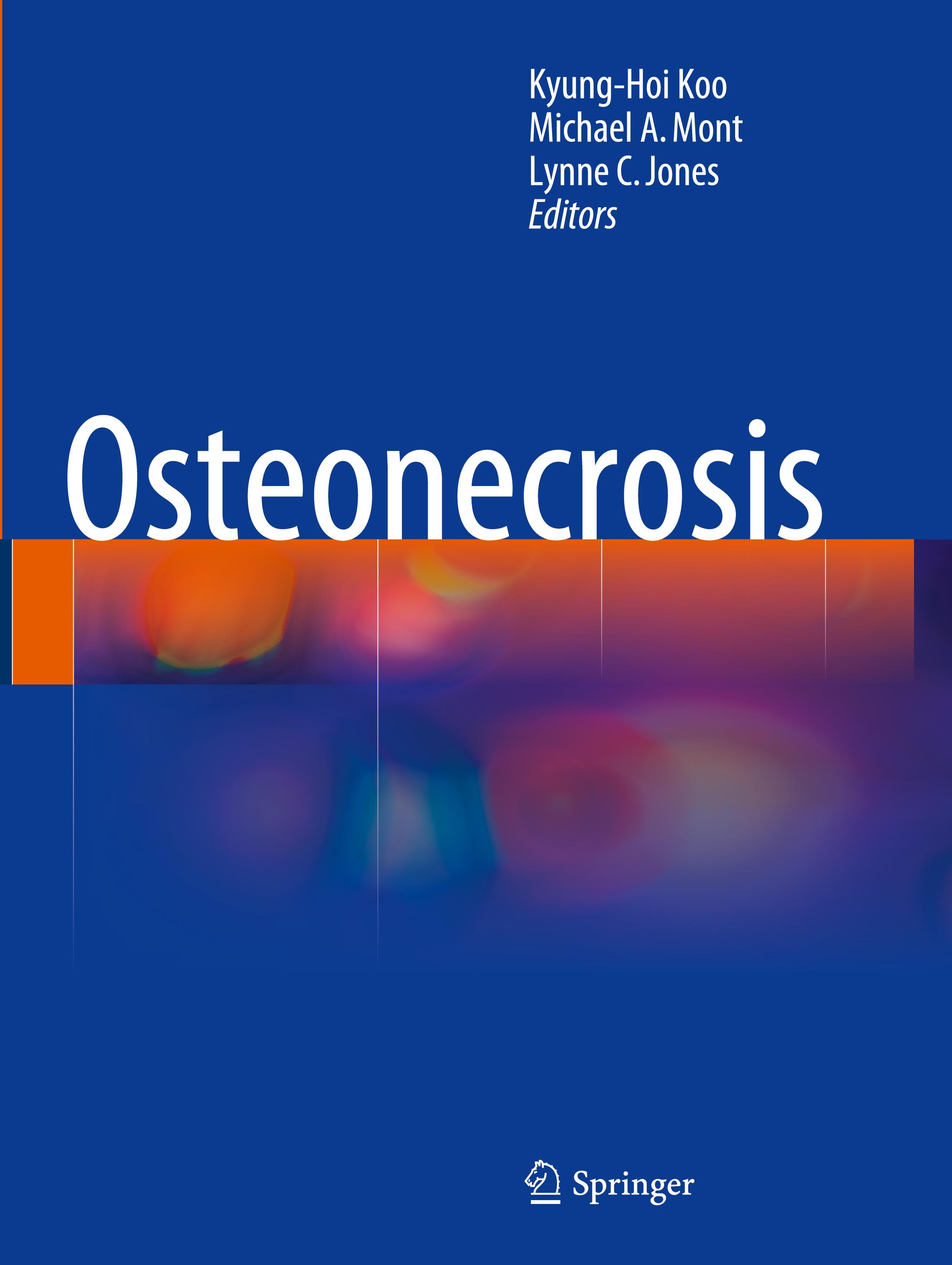 Osteonecrosis