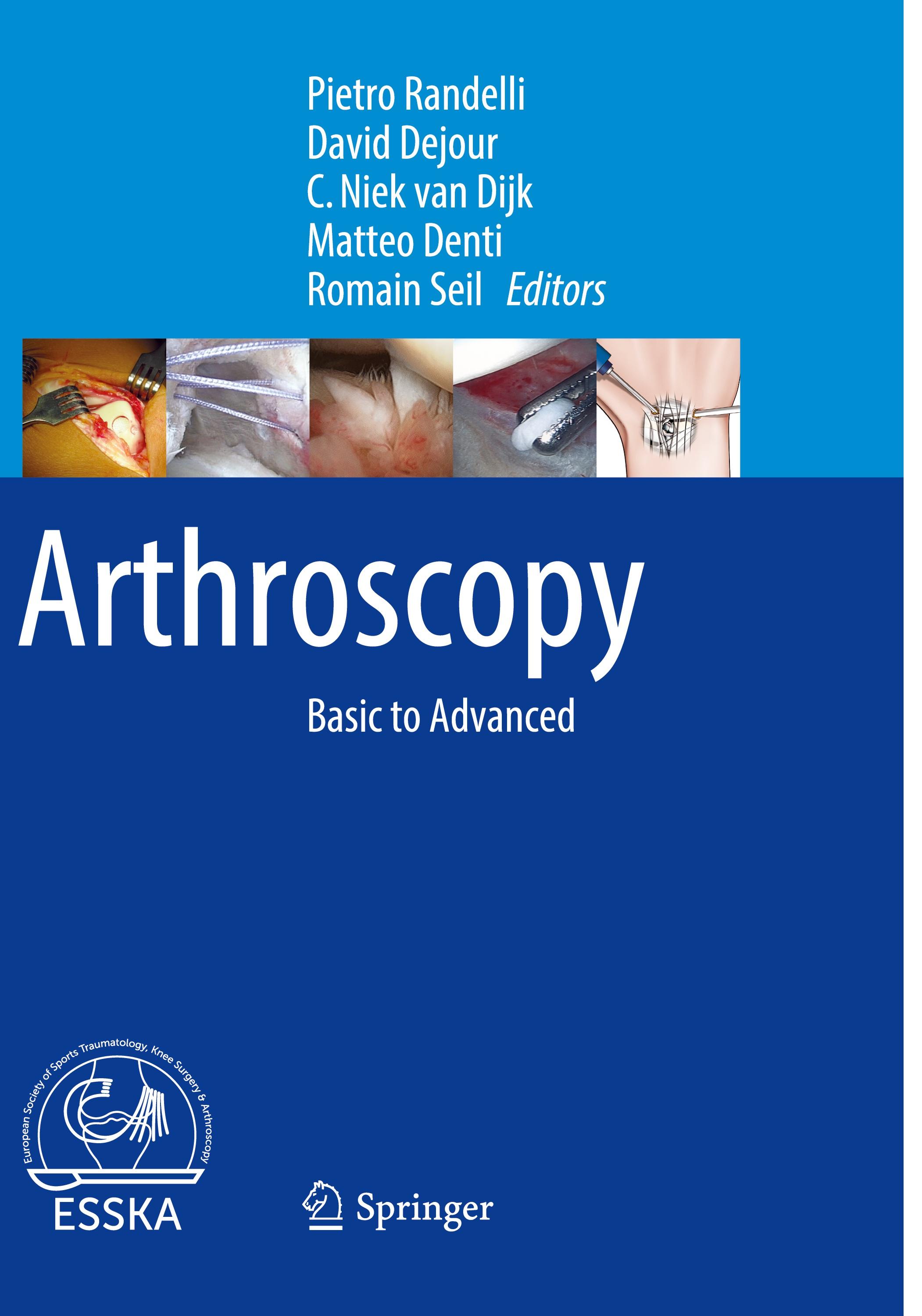 Arthroscopy