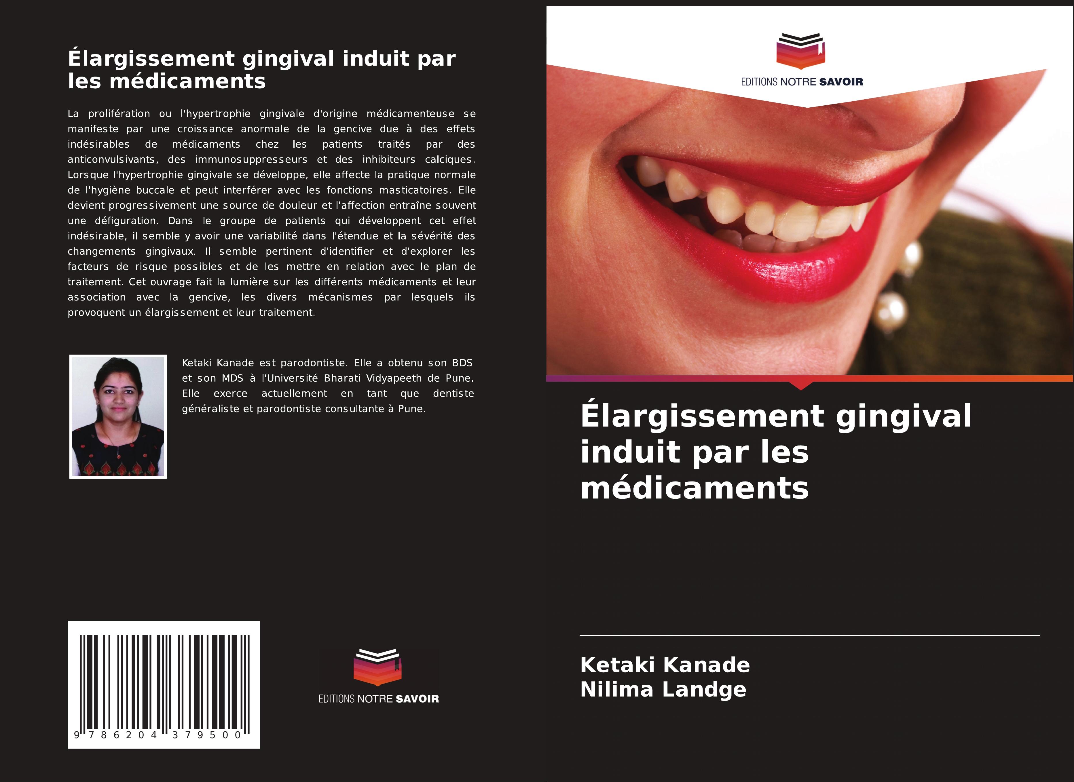 Élargissement gingival induit par les médicaments