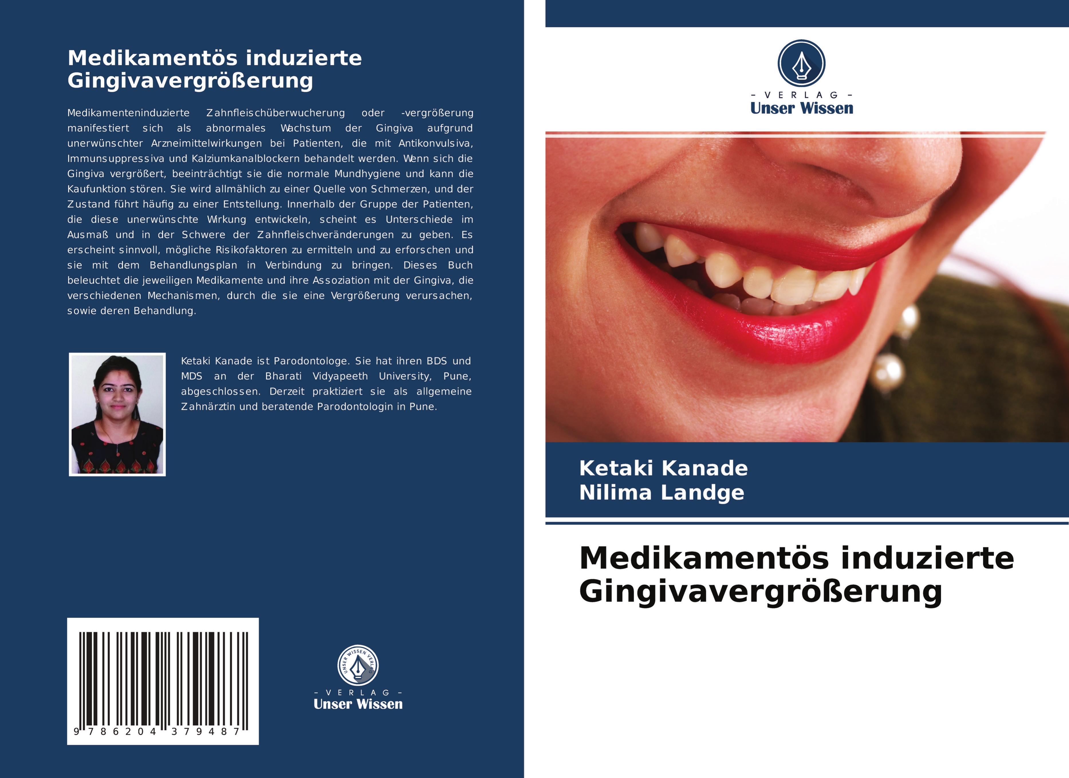 Medikamentös induzierte Gingivavergrößerung