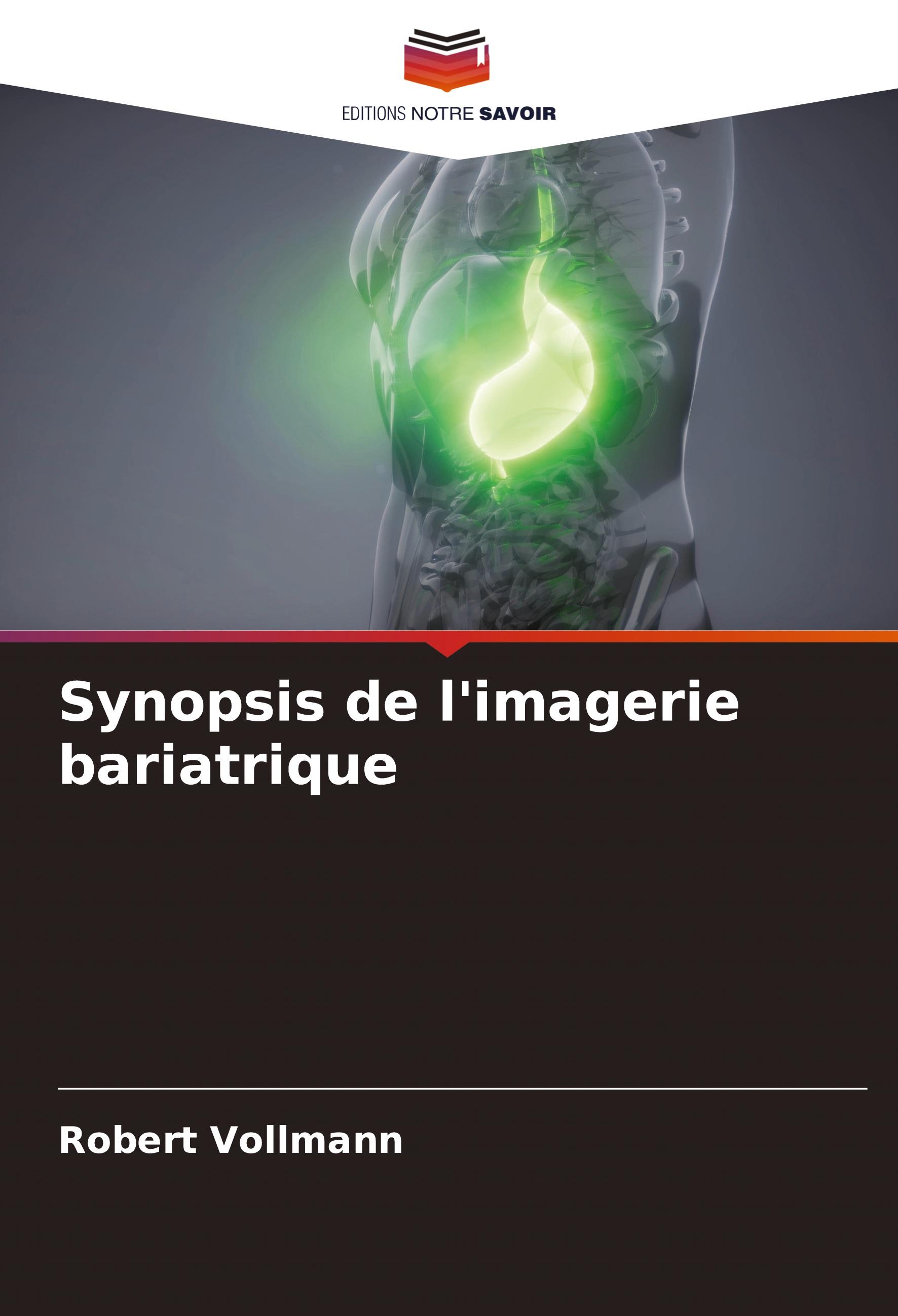 Synopsis de l'imagerie bariatrique