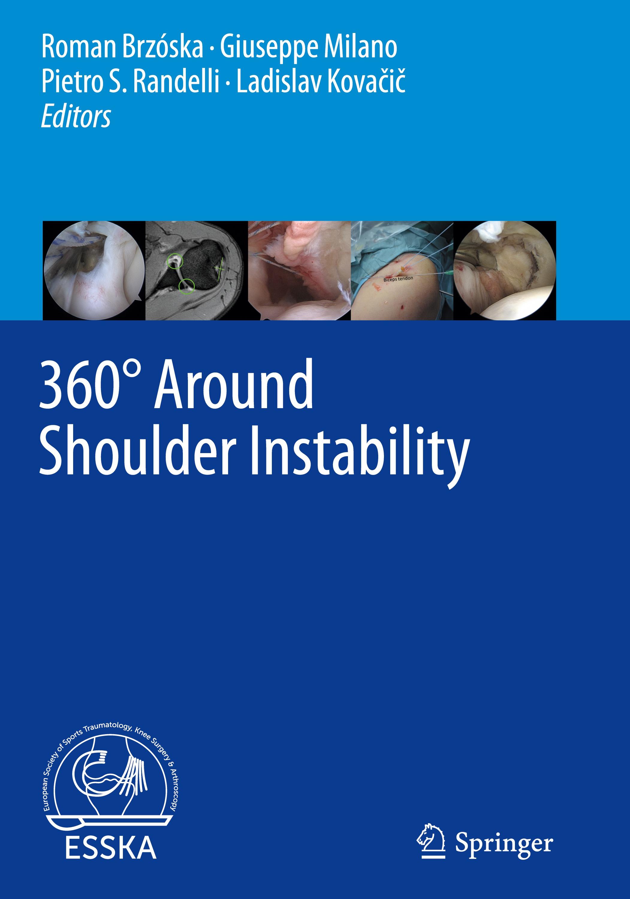 360° Around Shoulder Instability