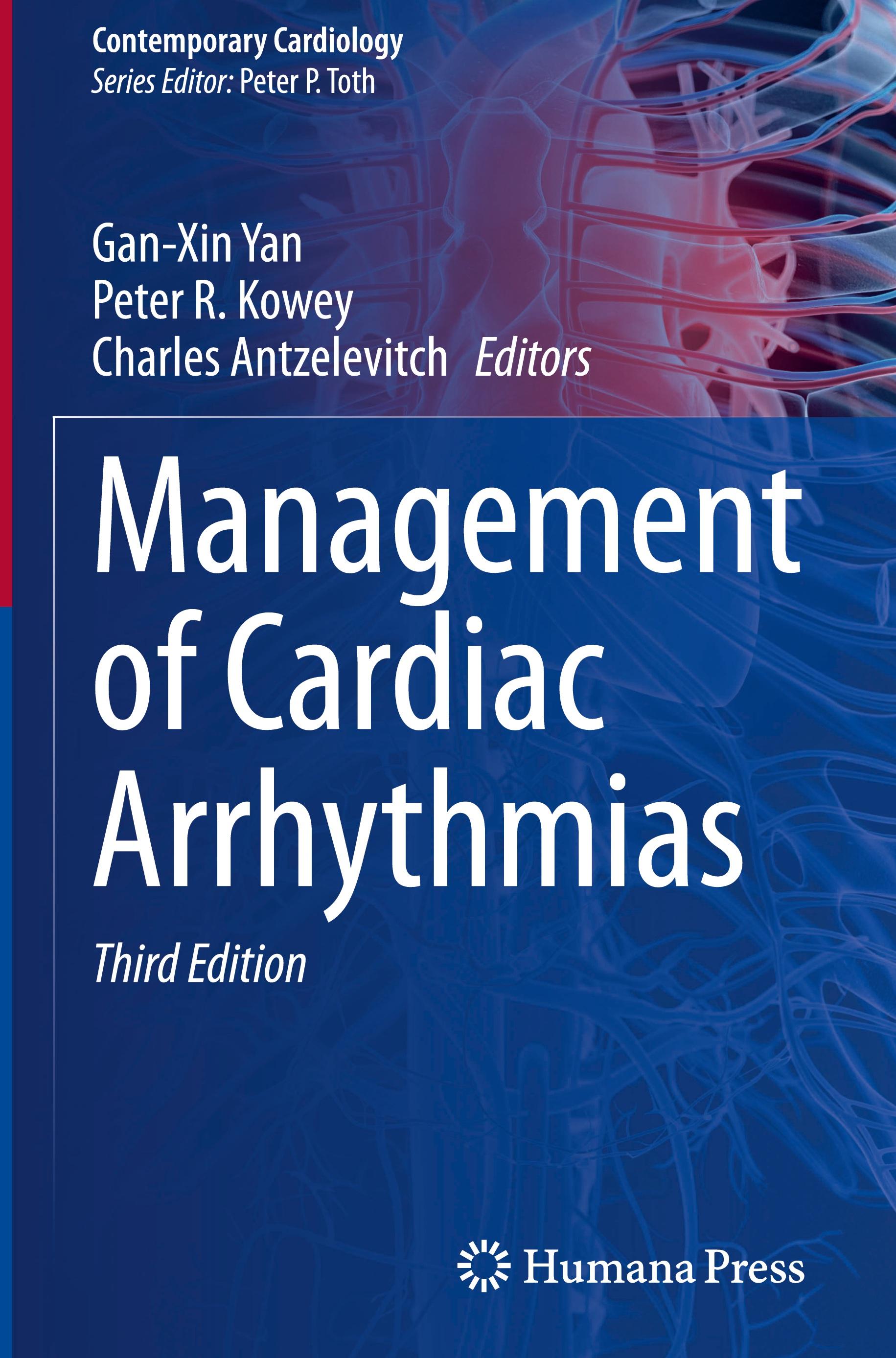 Management of Cardiac Arrhythmias