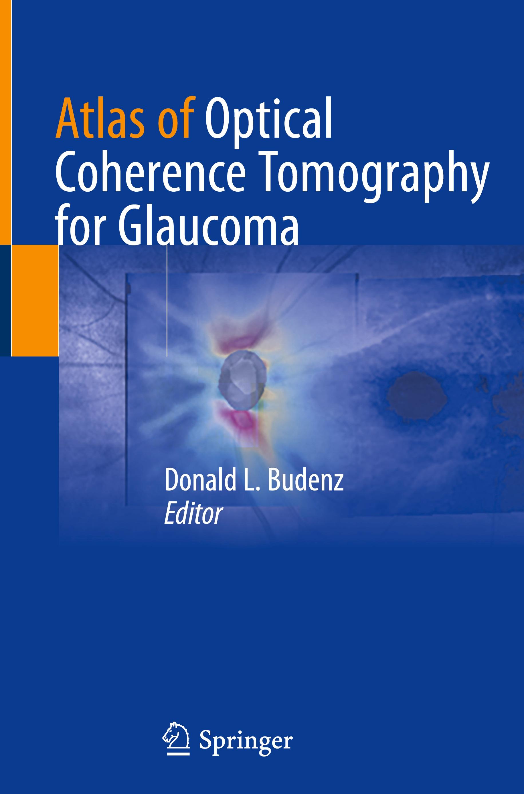 Atlas of Optical Coherence Tomography for Glaucoma