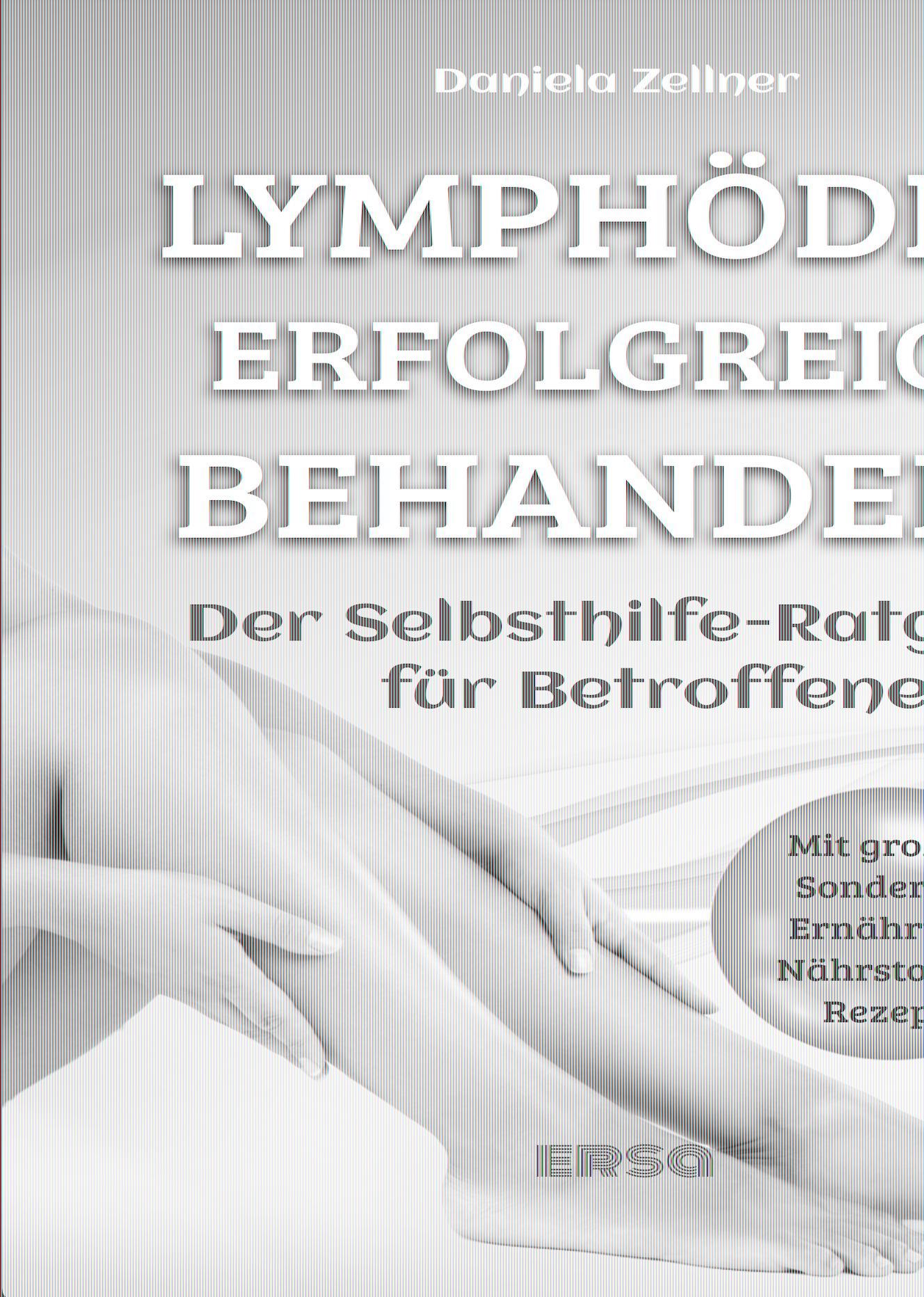 Lymphödem erfolgreich behandeln