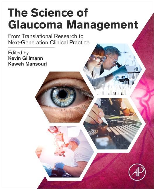 The Science of Glaucoma Management