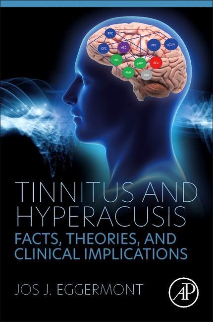 Tinnitus and Hyperacusis