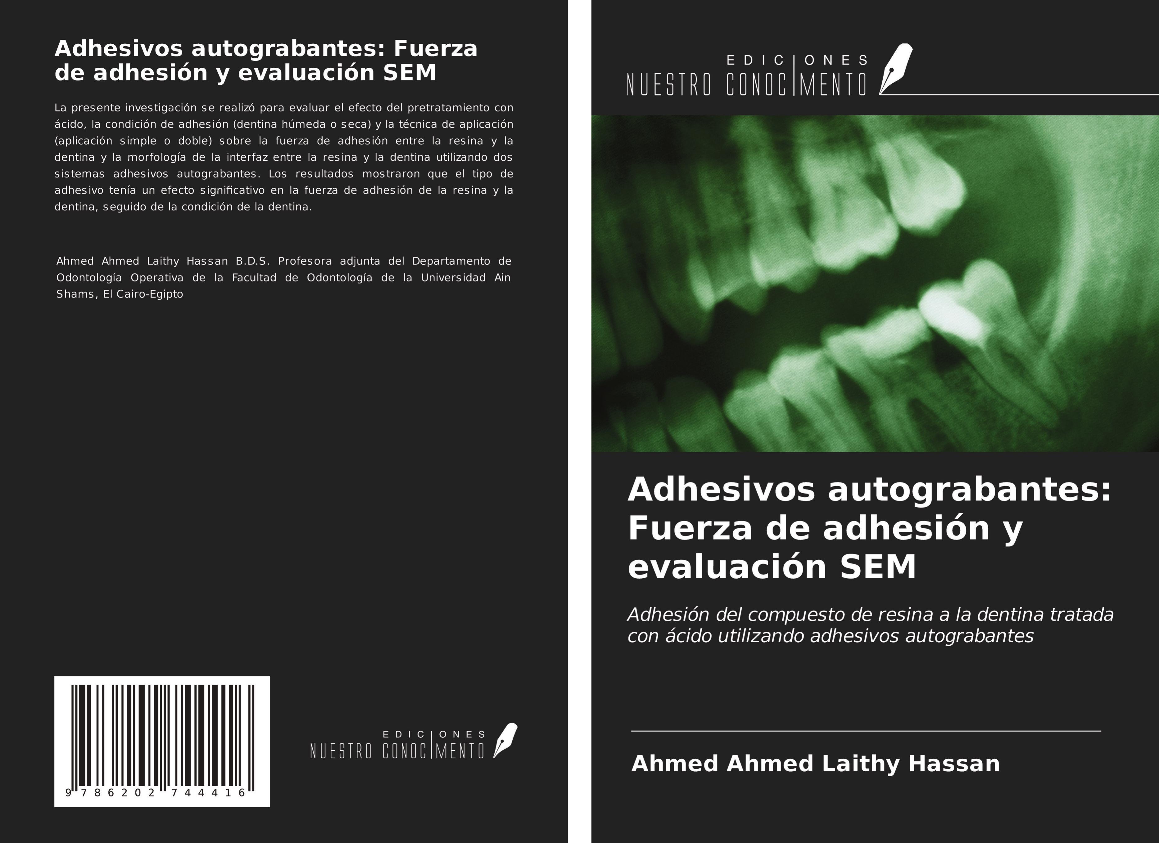 Adhesivos autograbantes: Fuerza de adhesión y evaluación SEM