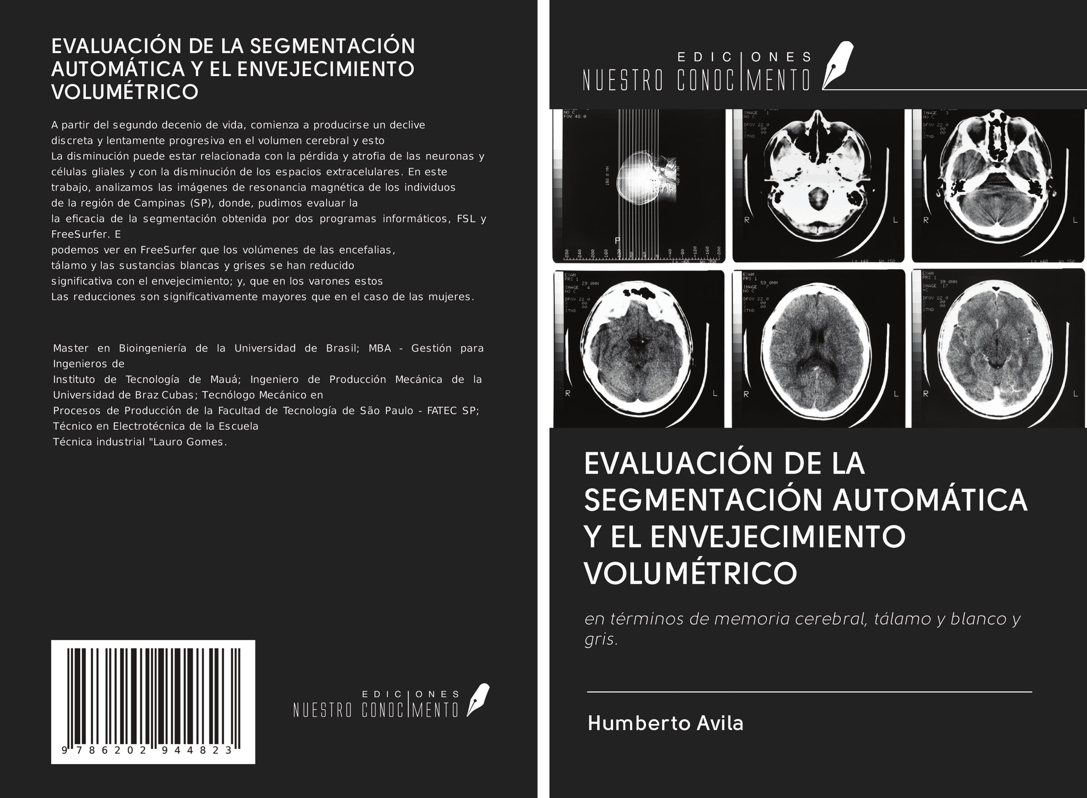 EVALUACIÓN DE LA SEGMENTACIÓN AUTOMÁTICA Y EL ENVEJECIMIENTO VOLUMÉTRICO